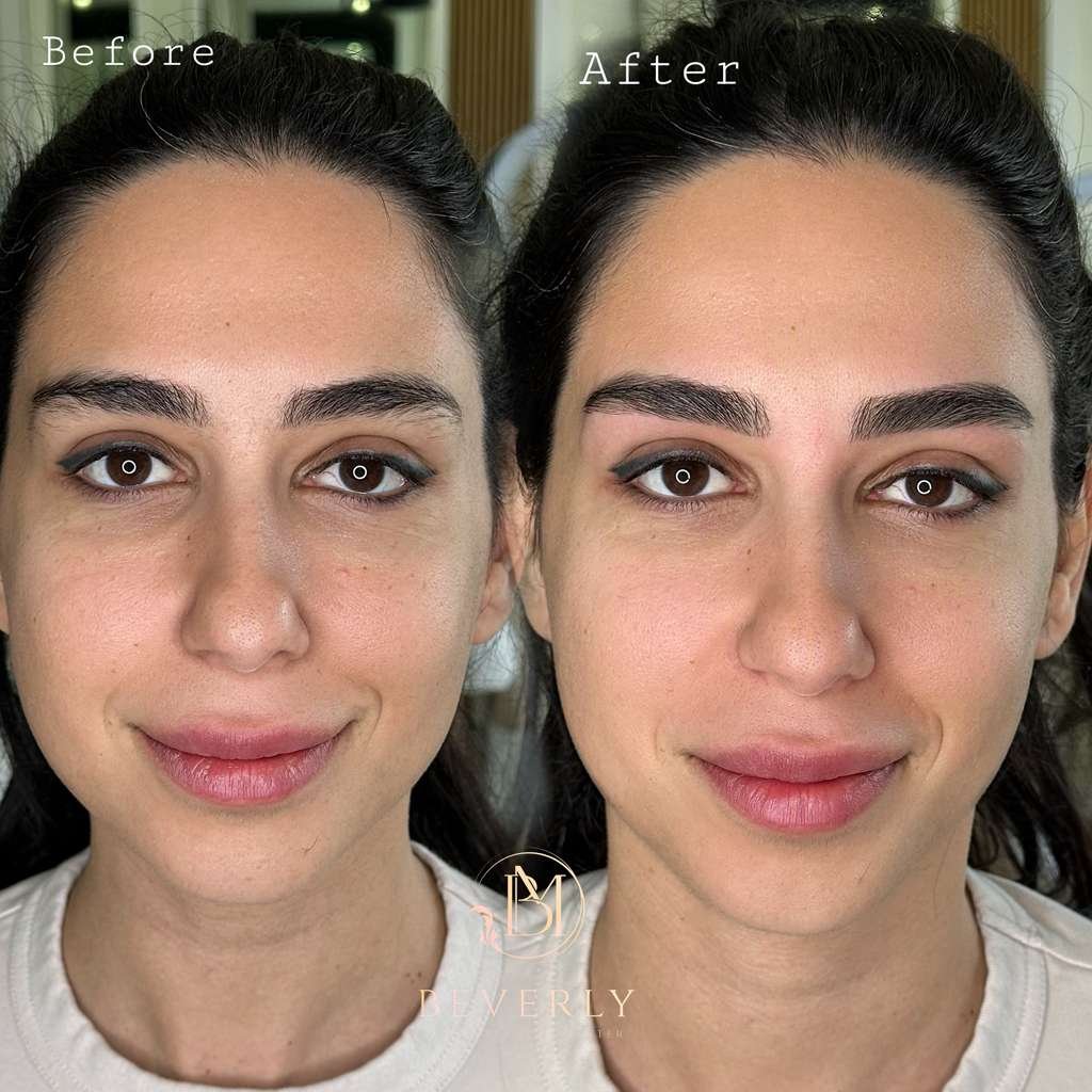 services before after (1)