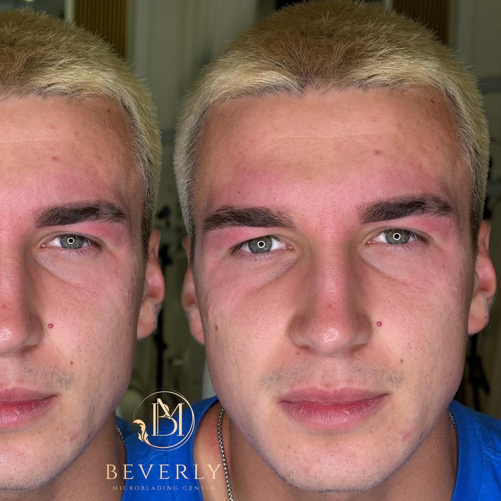 services before after (10)