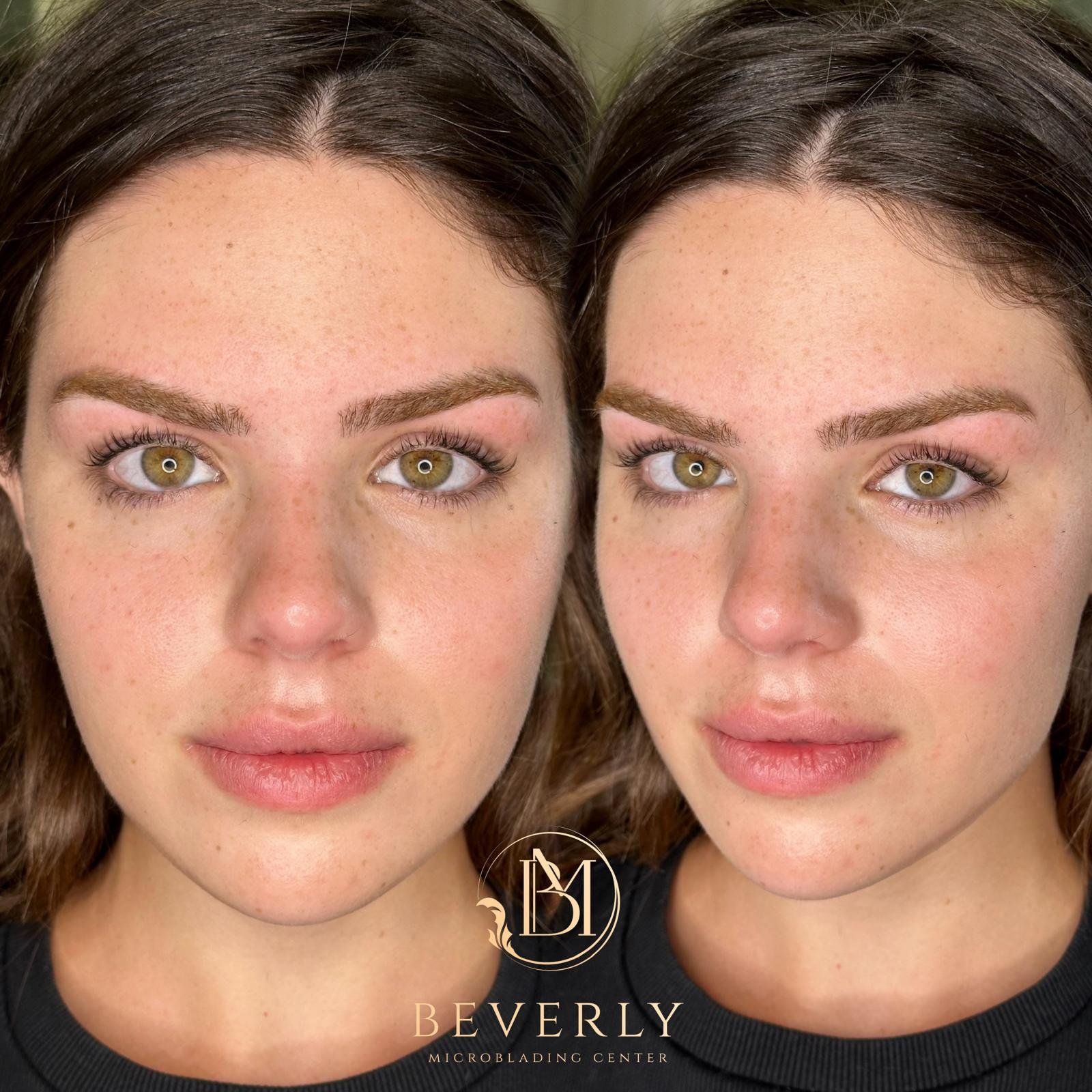 services before after (11)