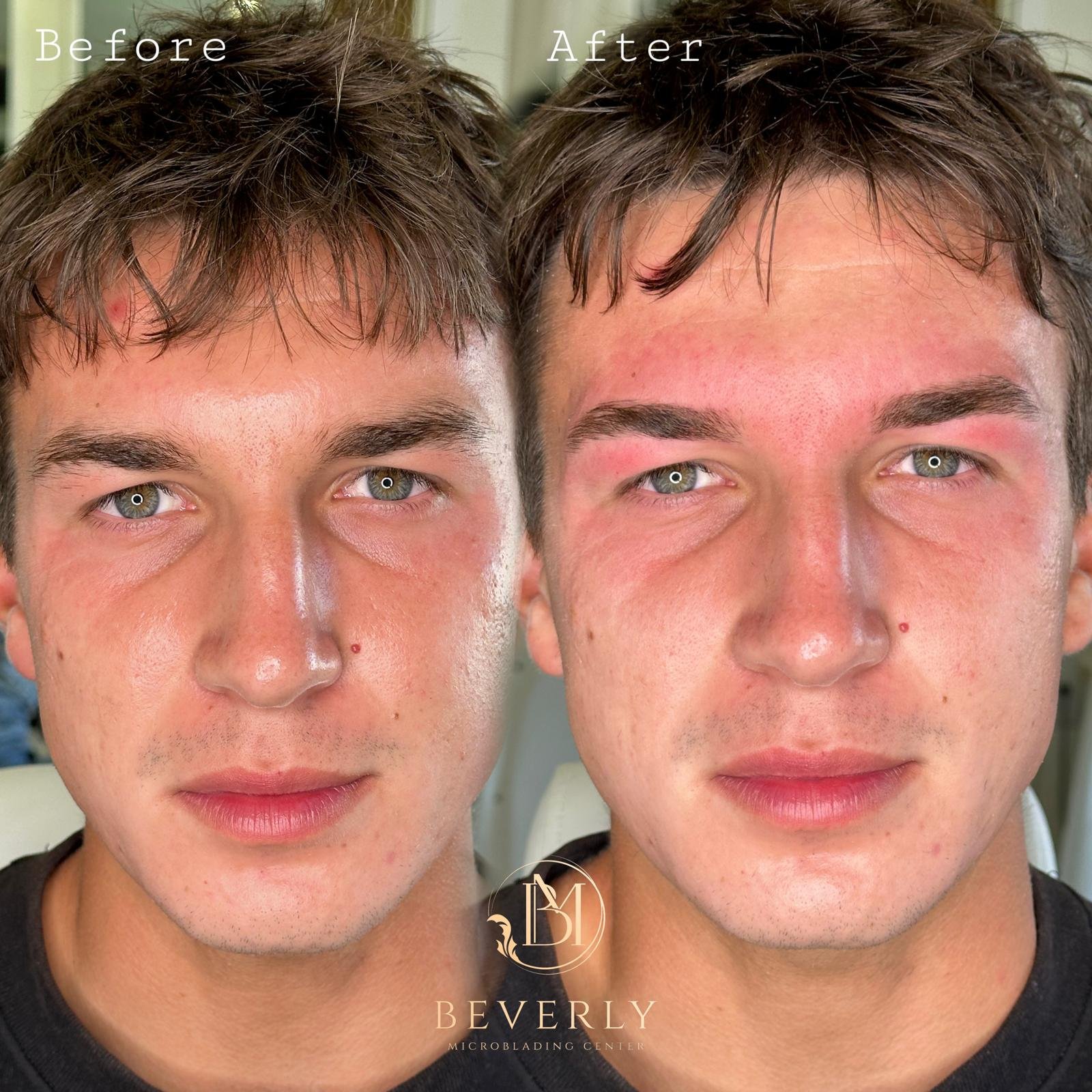 services before after (12)