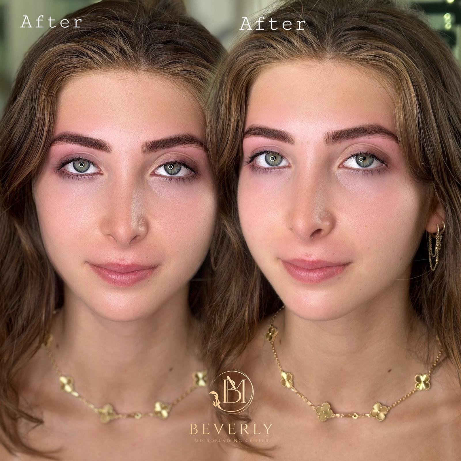 services before after (13)
