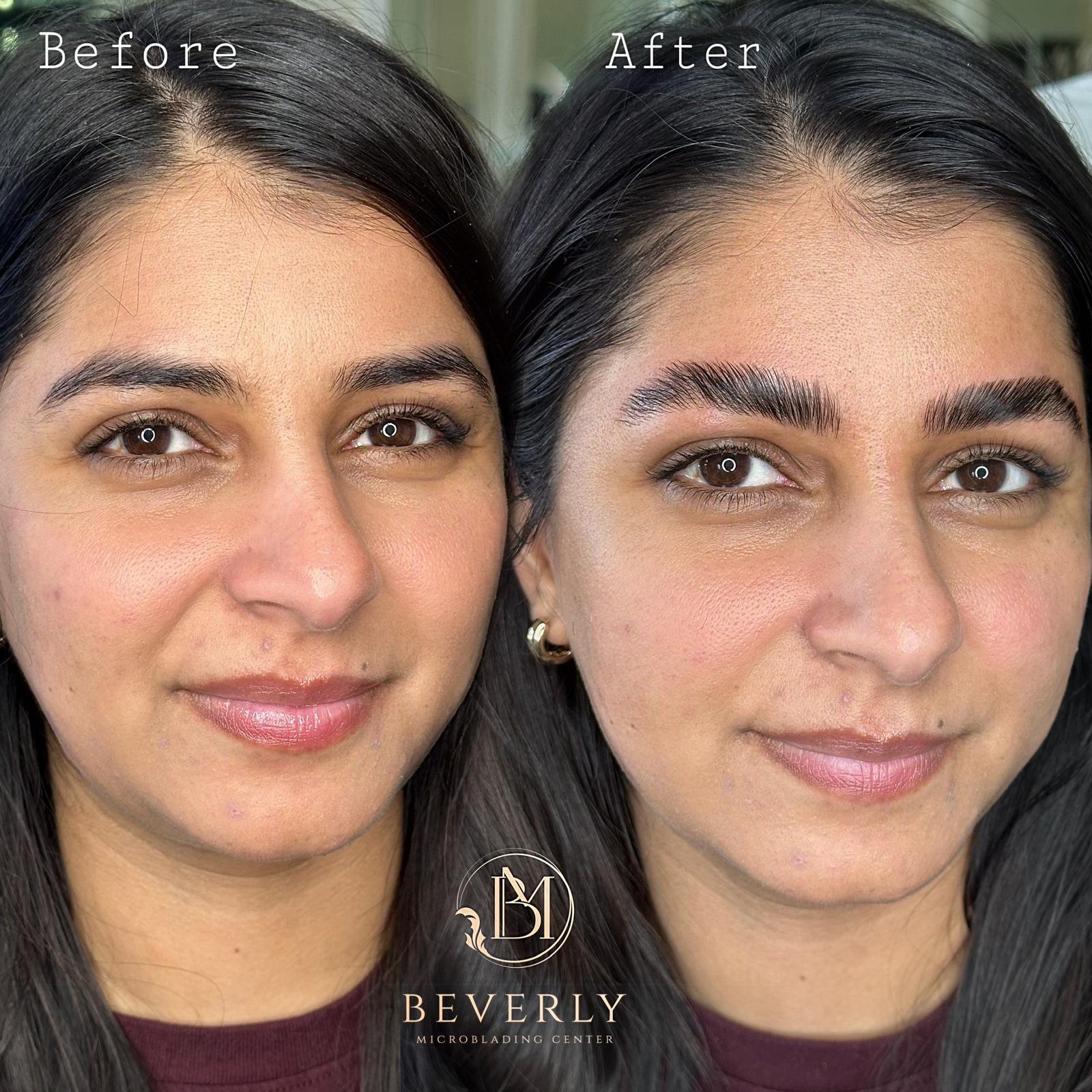 services before after (14)