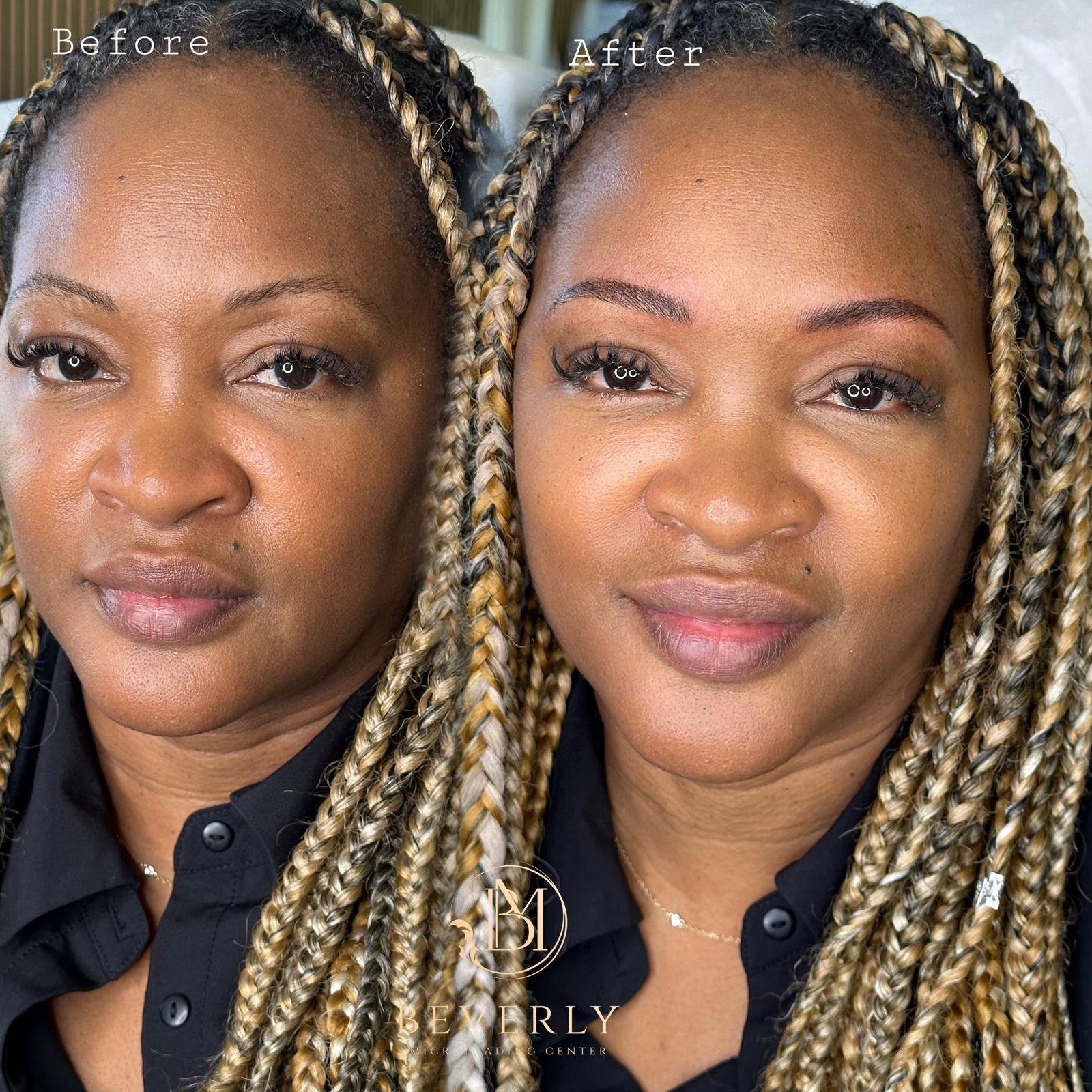 services before after (15)