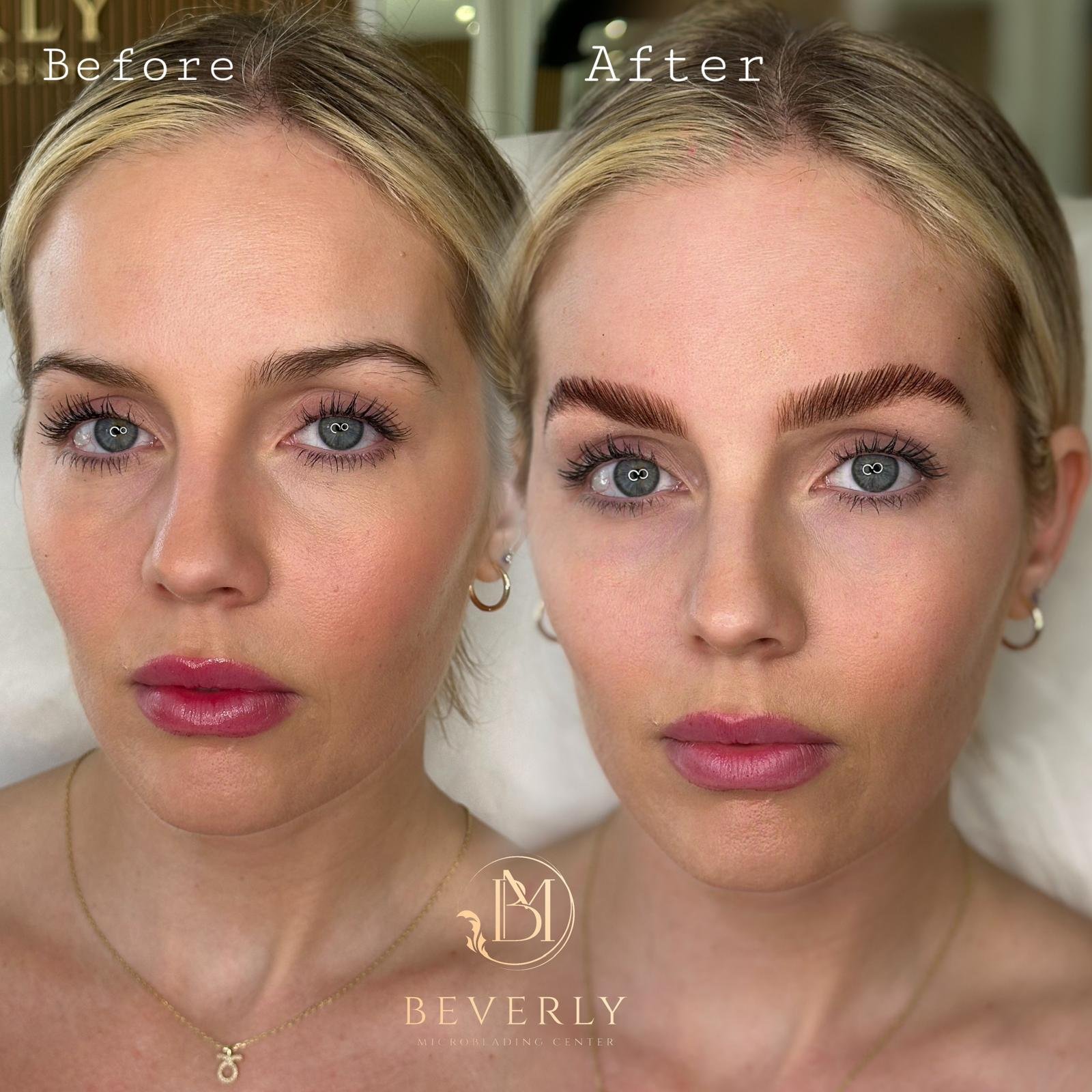 services before after (18)