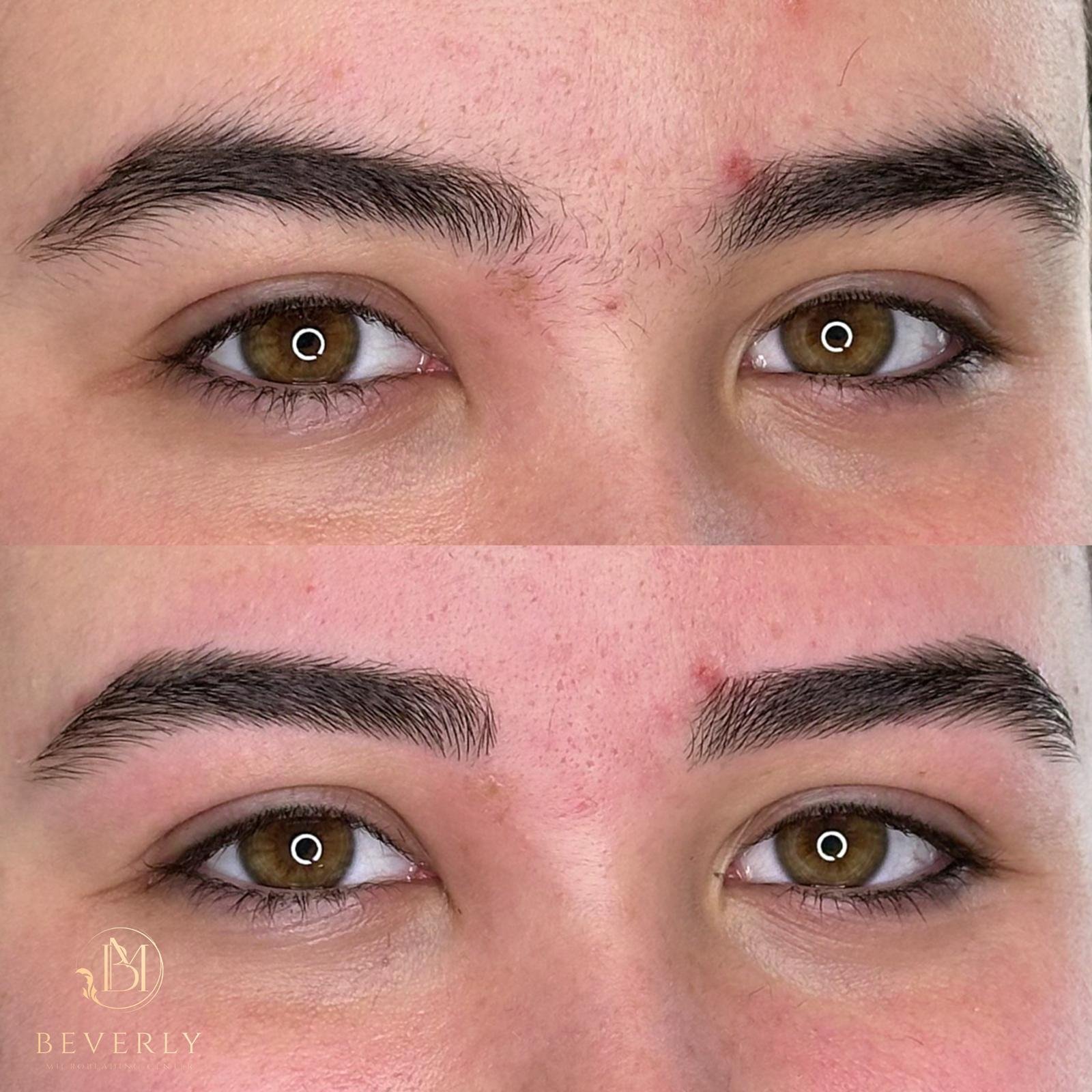 services before after (2)