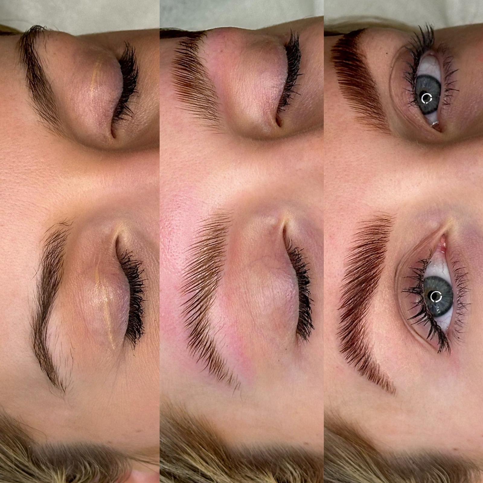 services before after (21)