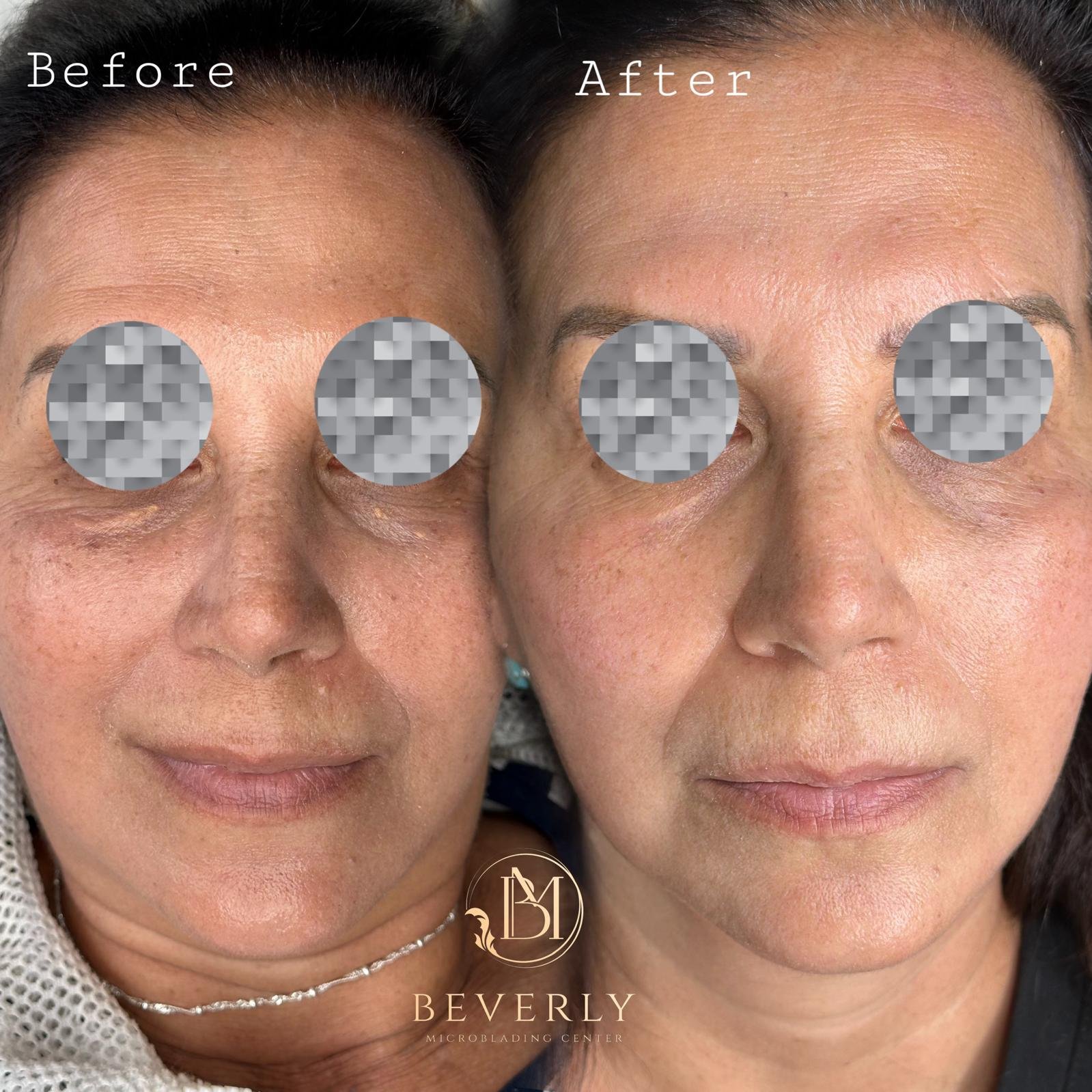 services before after (22)