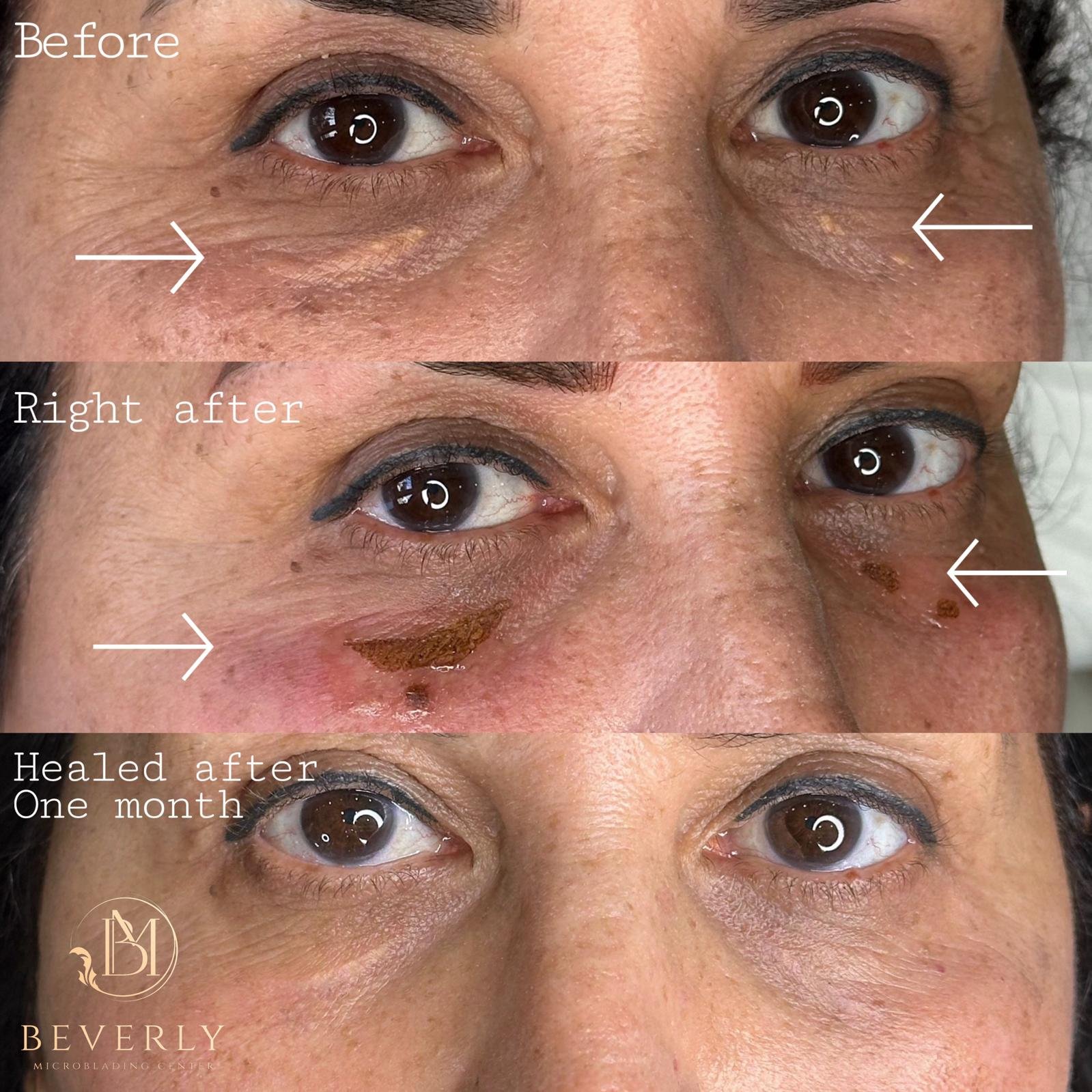 services before after (23)
