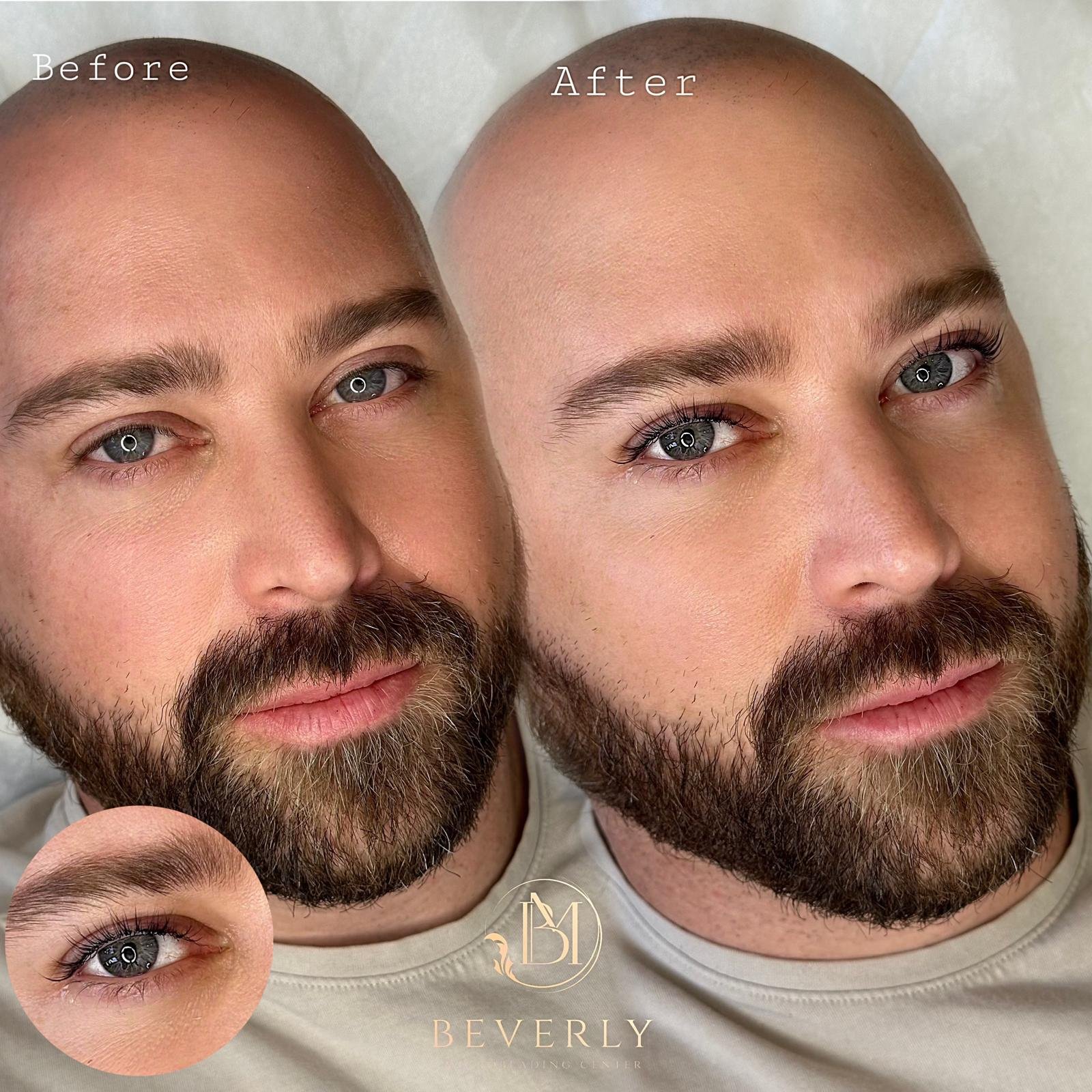 services before after (25)