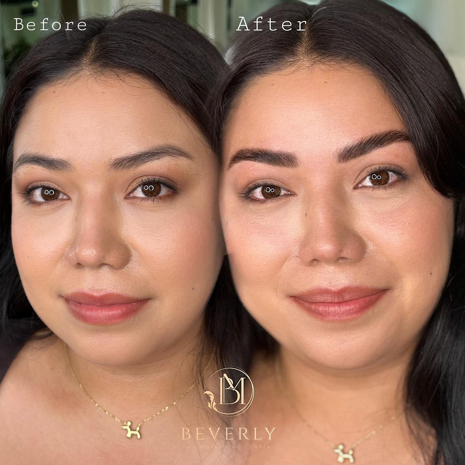 services before after (26)