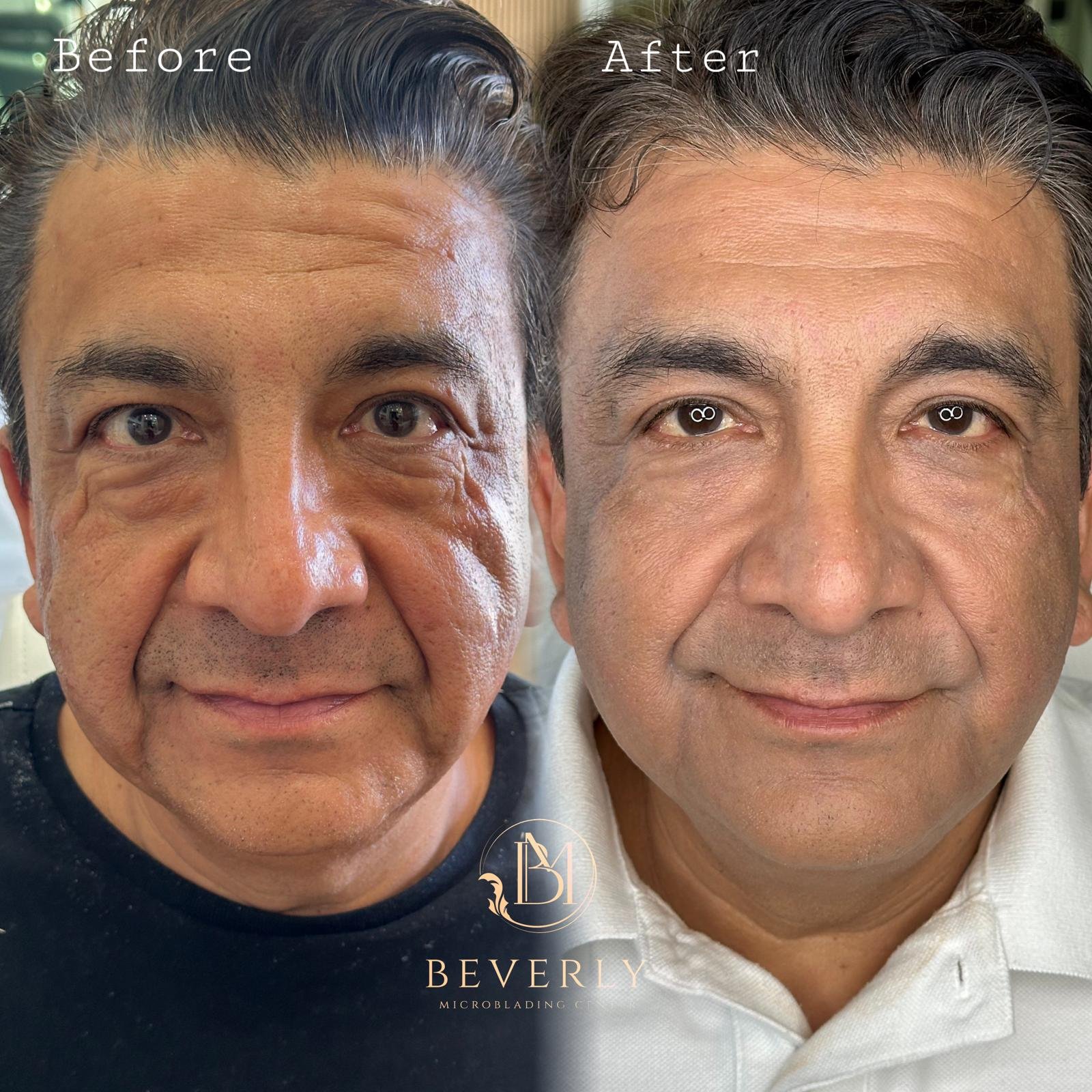 services before after (28)