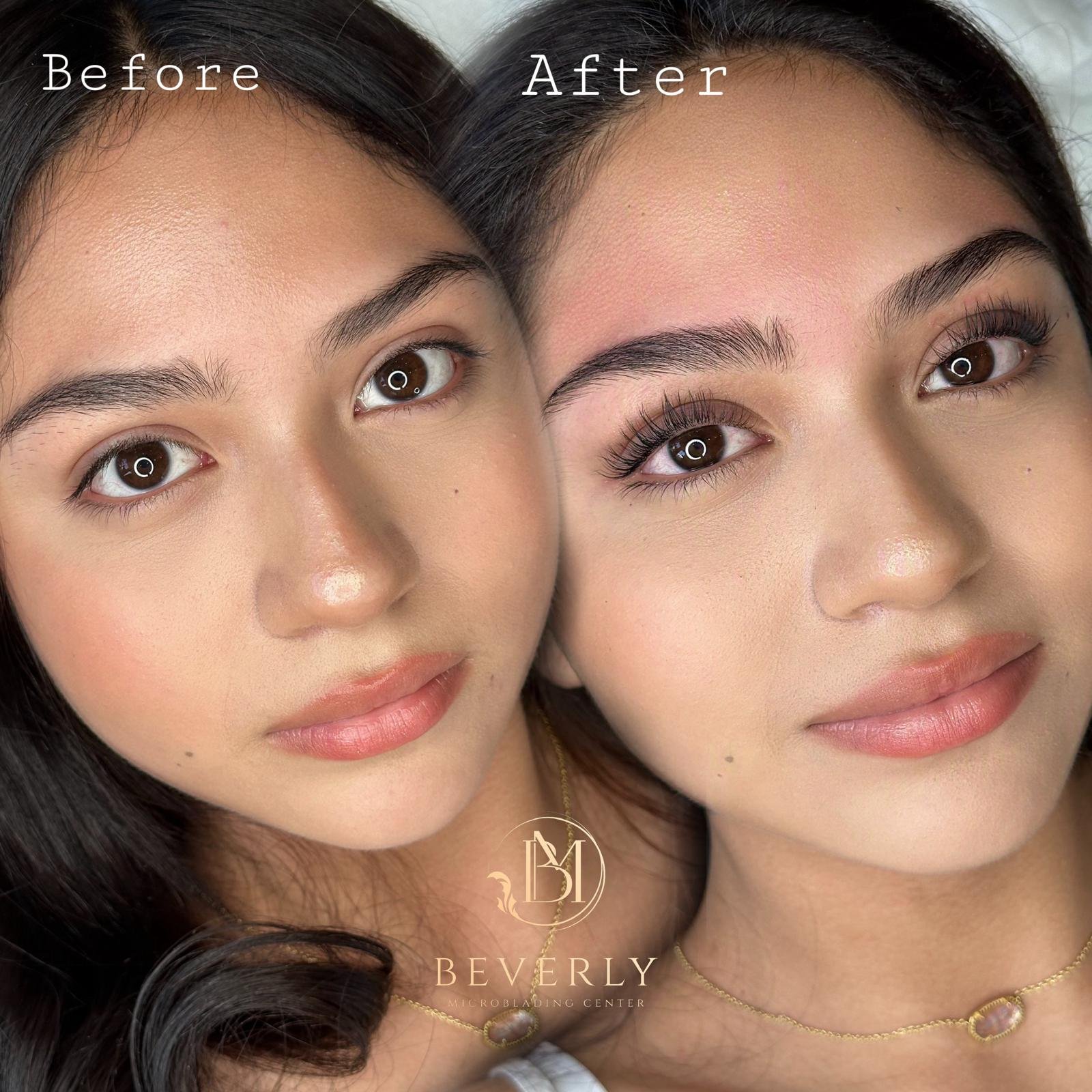 services before after (29)