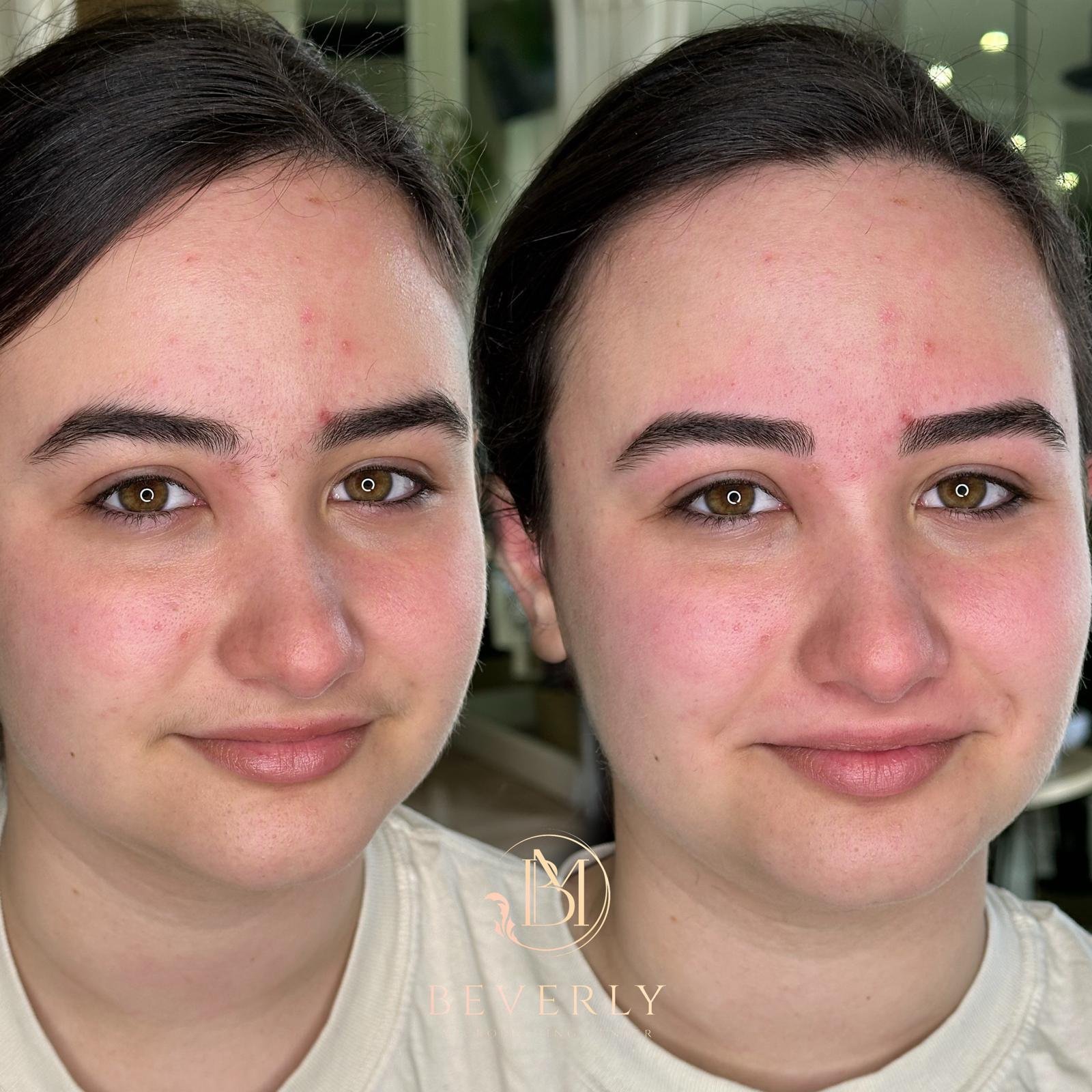 services before after (3)
