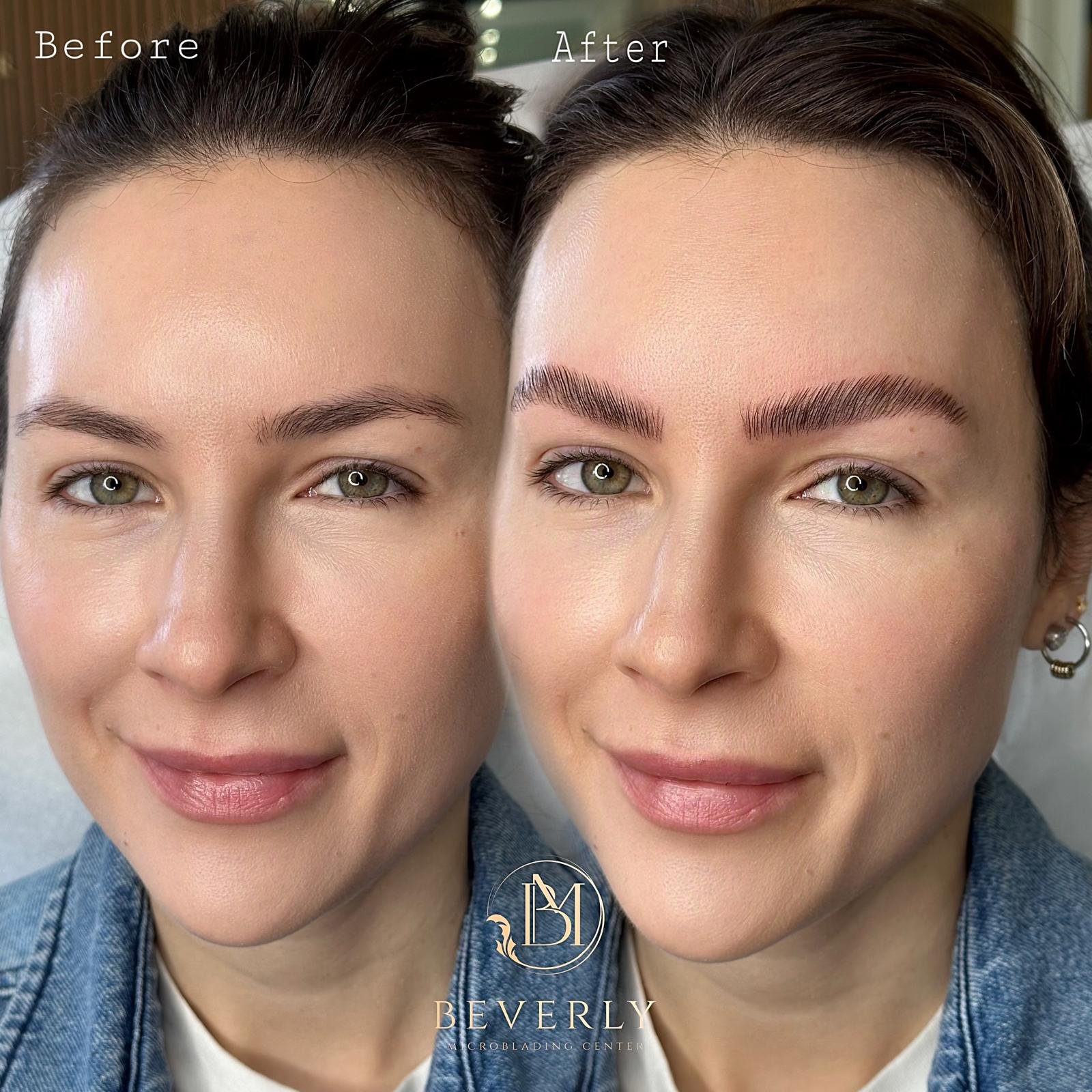 services before after (30)