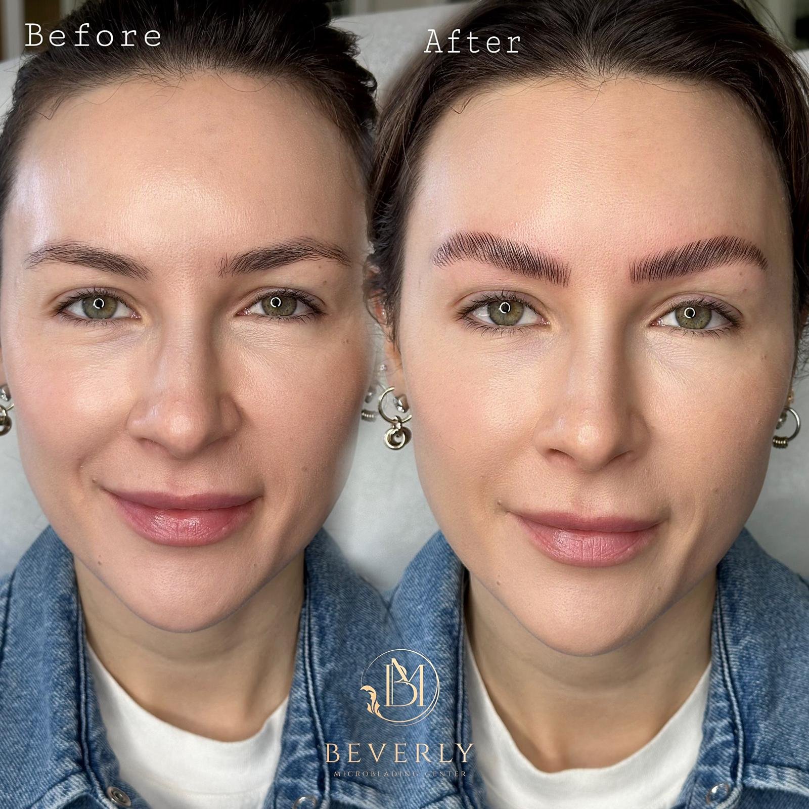 services before after (31)