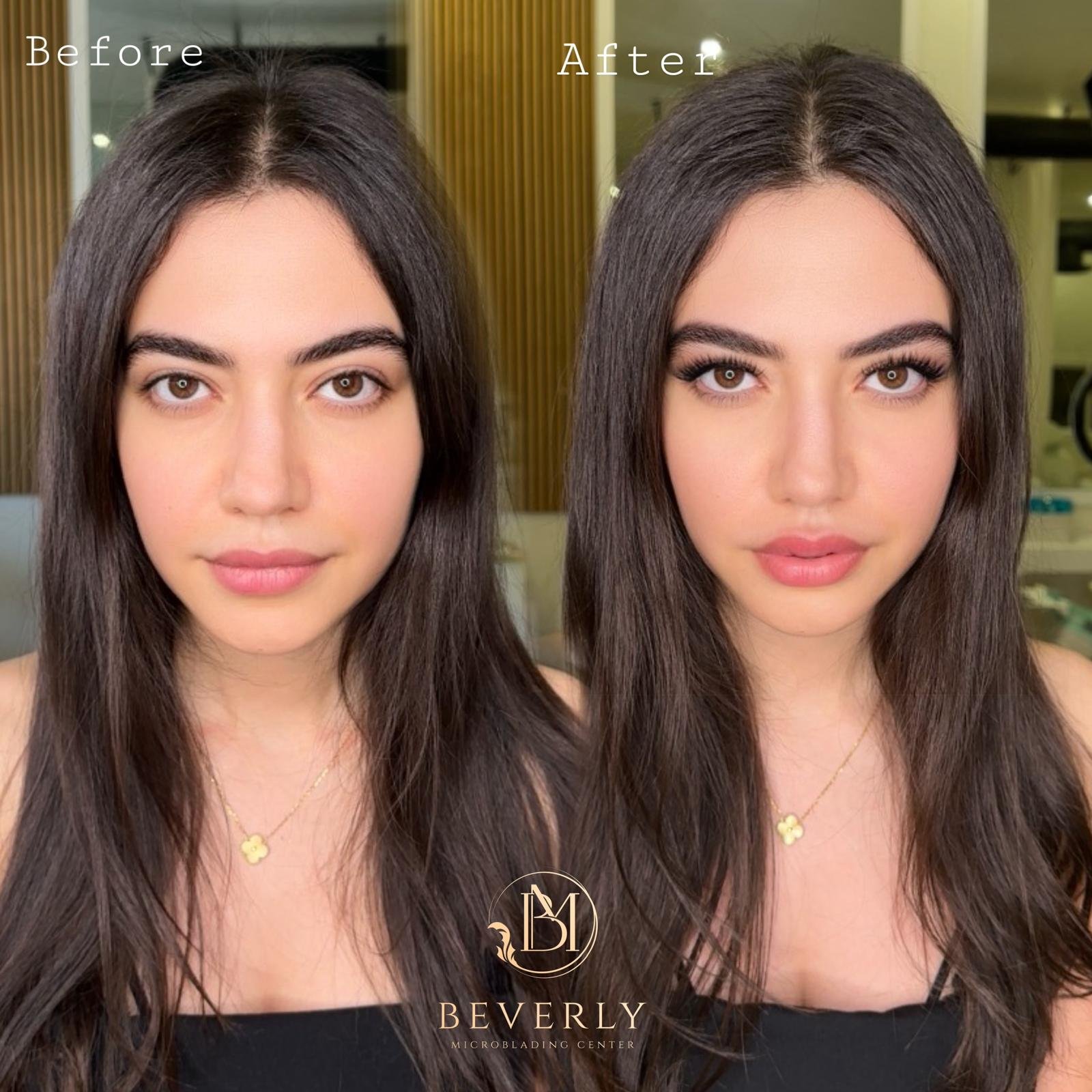 services before after (32)