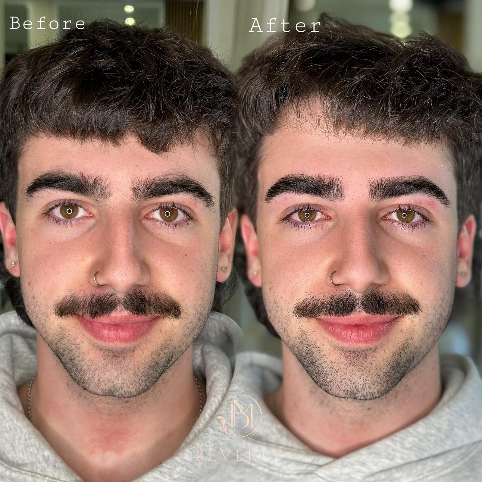 services before after (33)