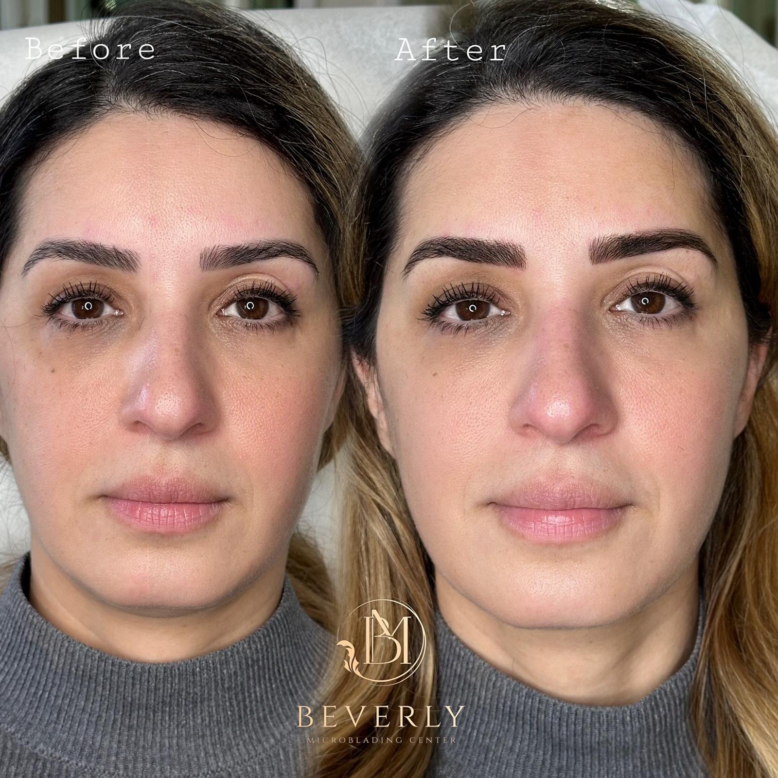 services before after (34)