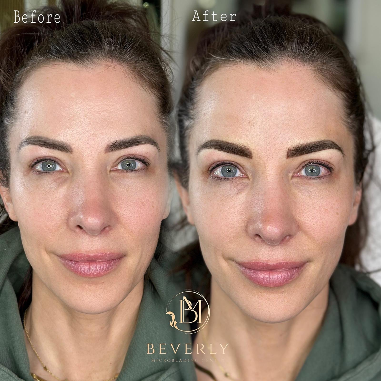 services before after (35)