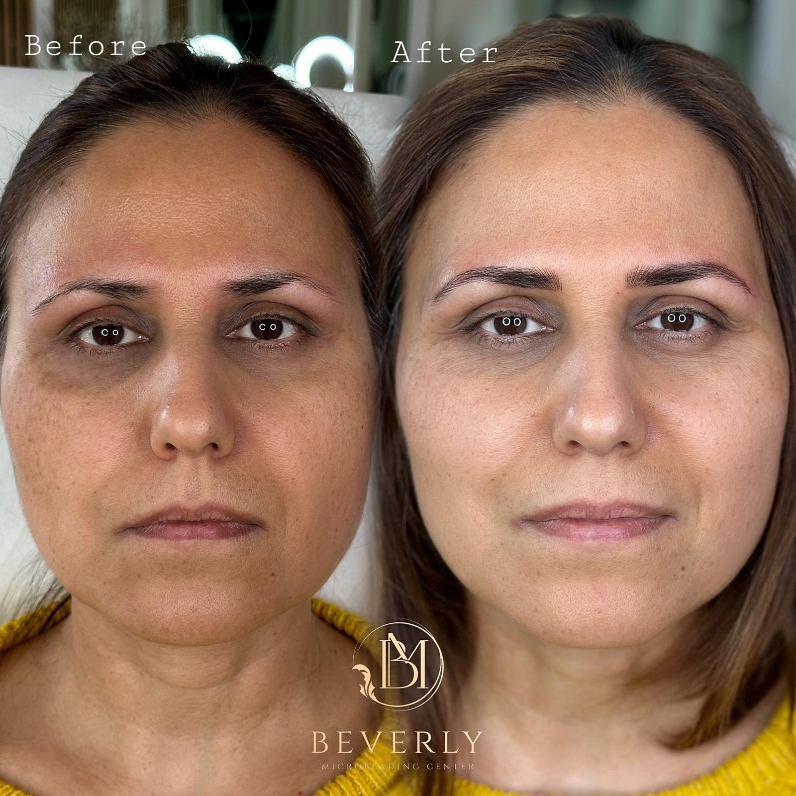services before after (36)
