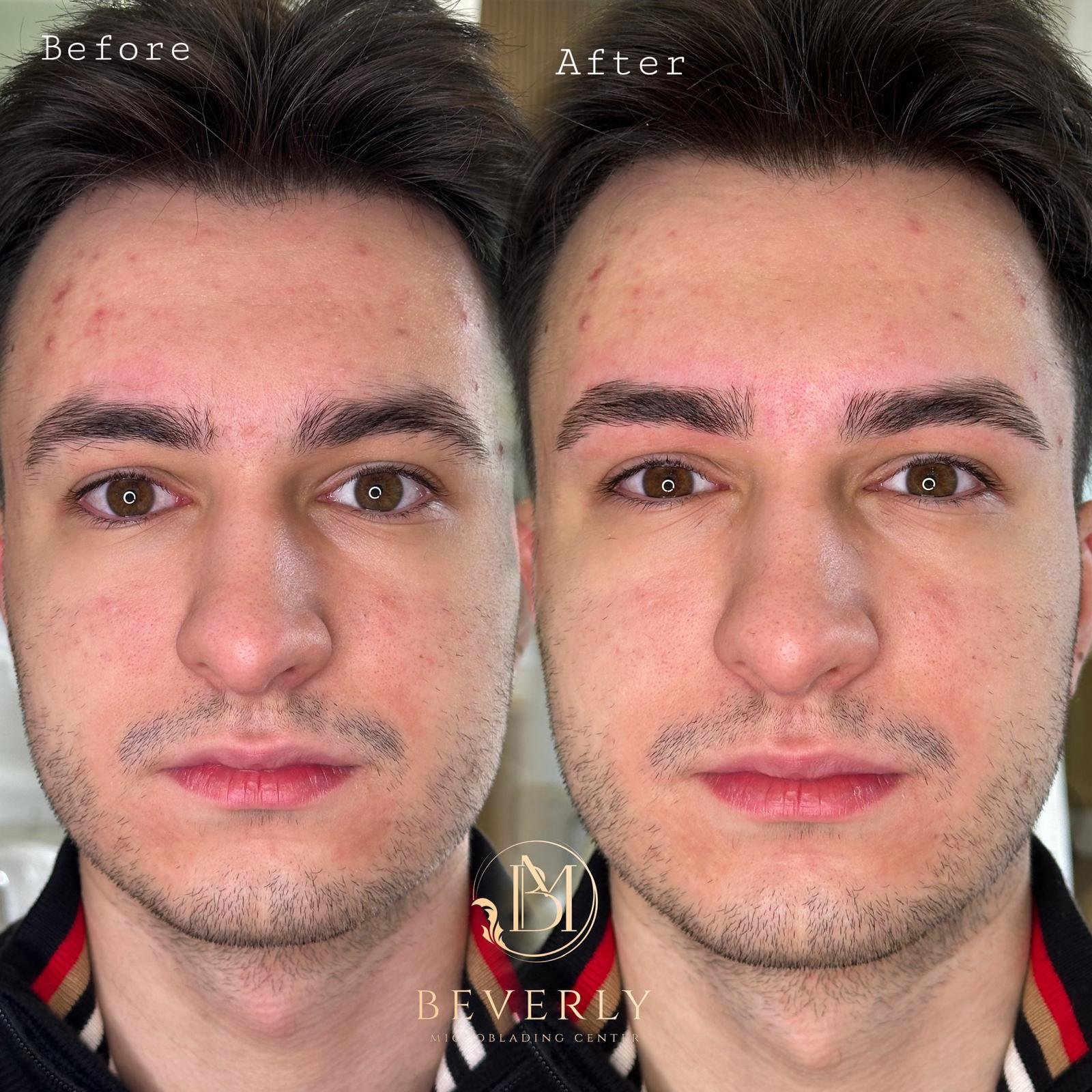 services before after (37)