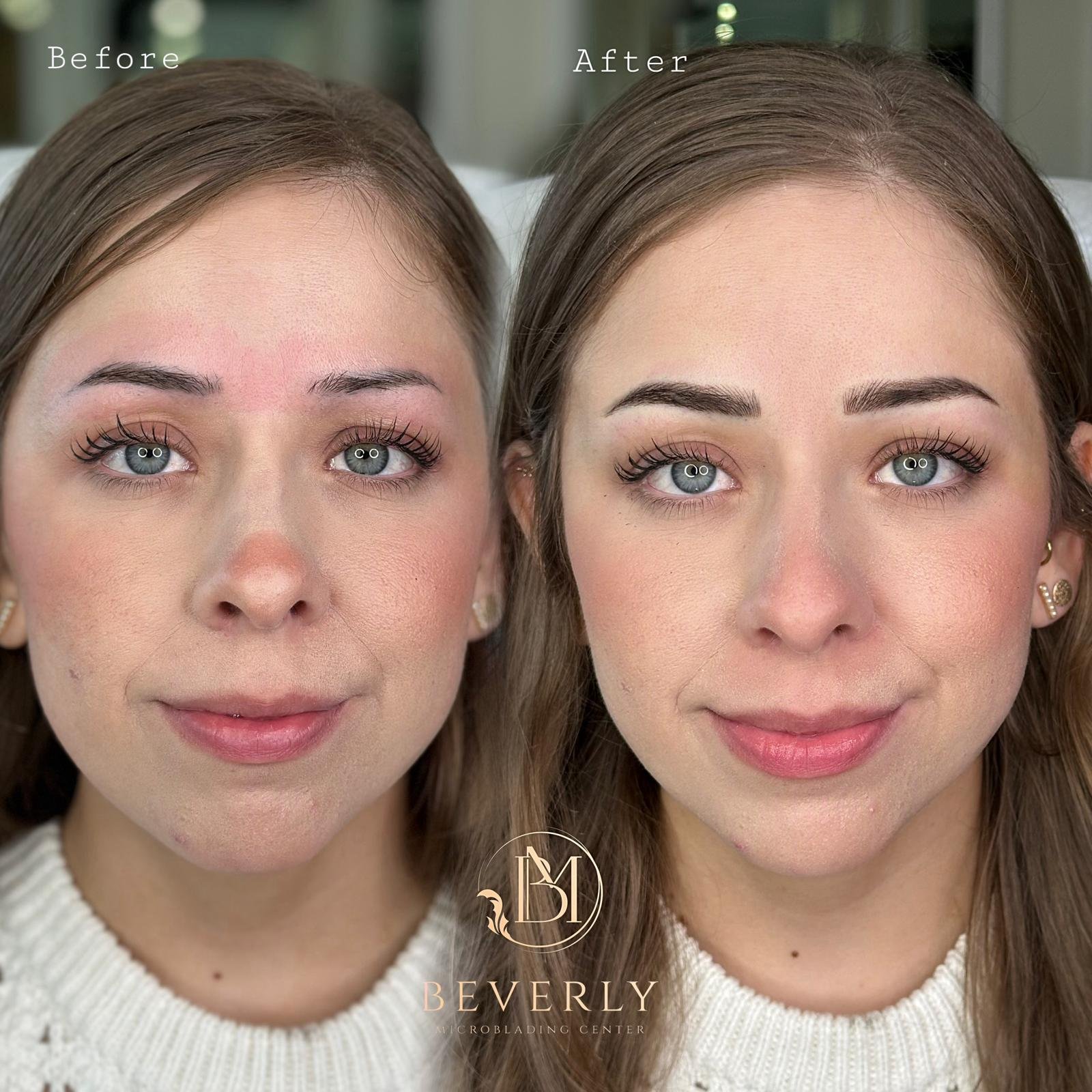 services before after (38)