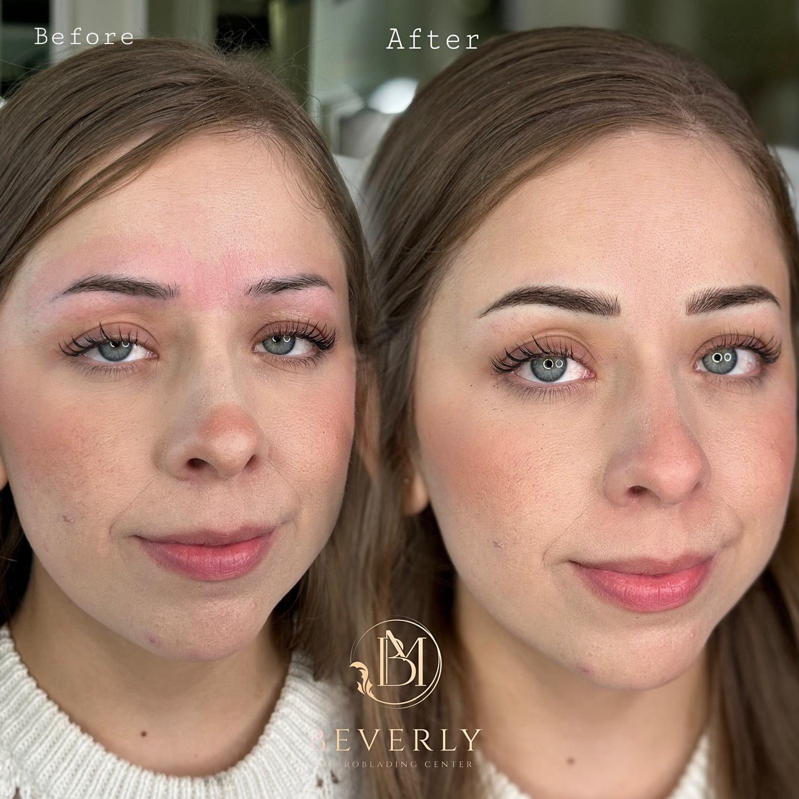 services before after (39)