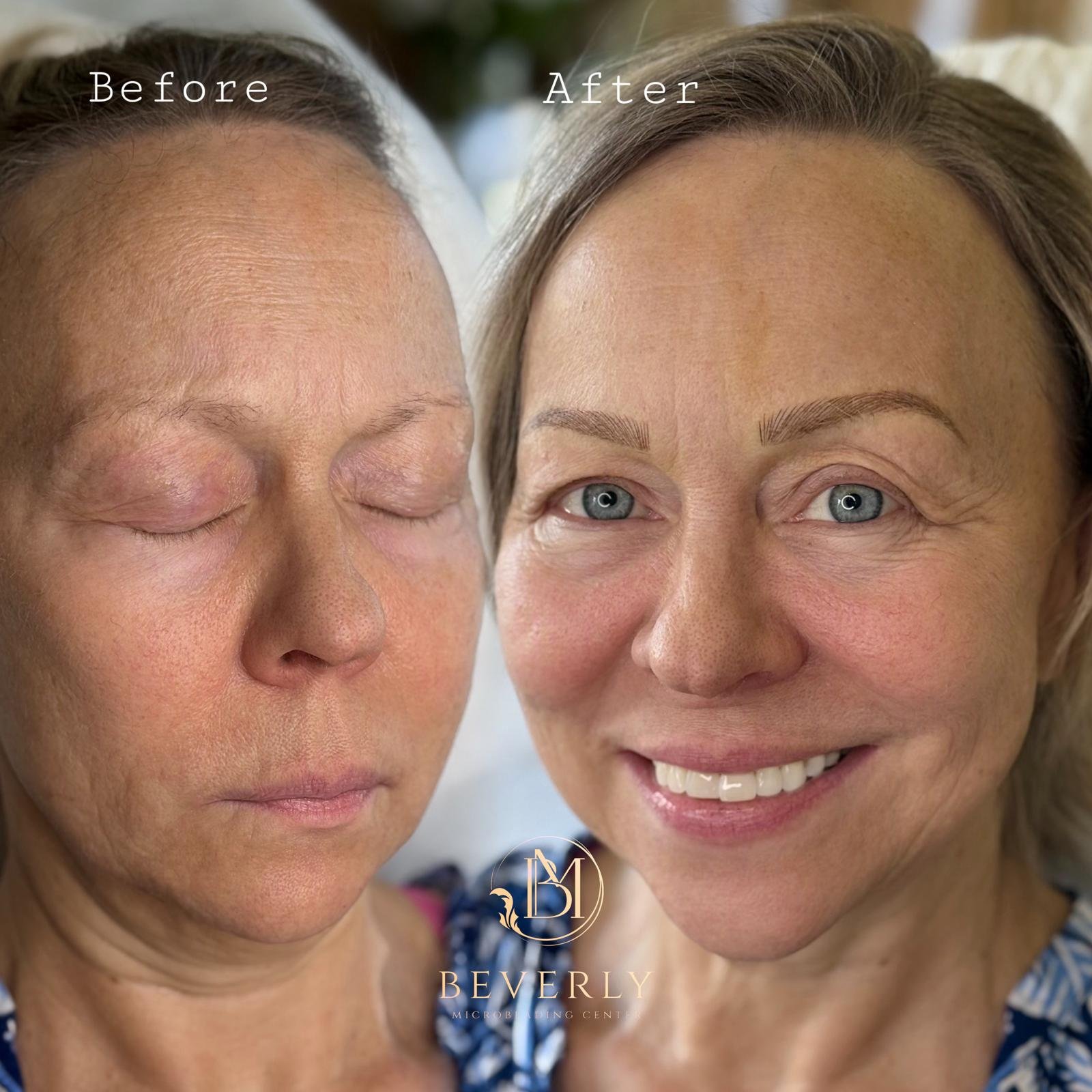 services before after (4)