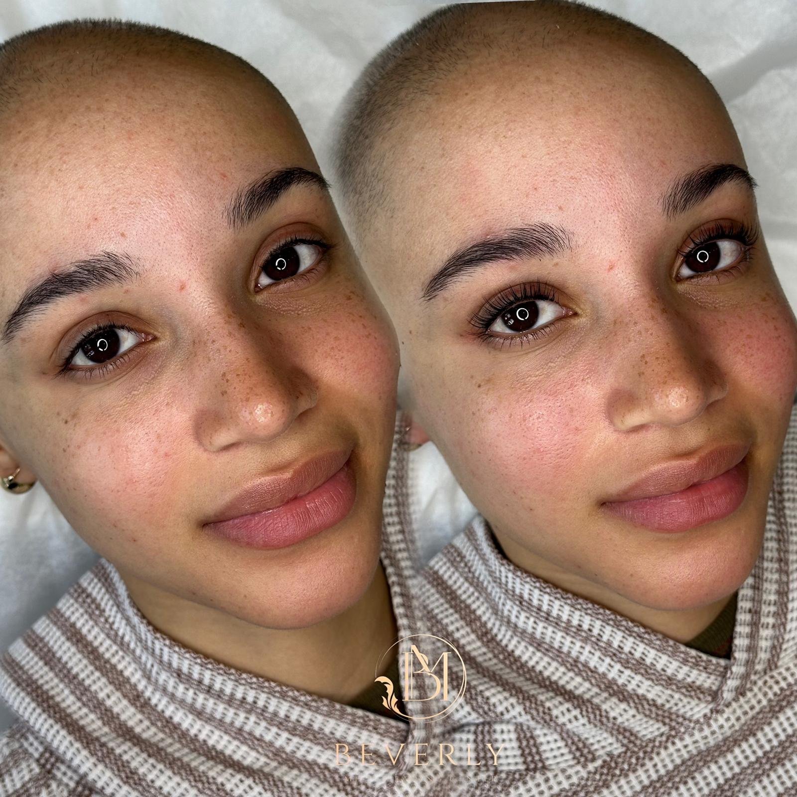 services before after (40)