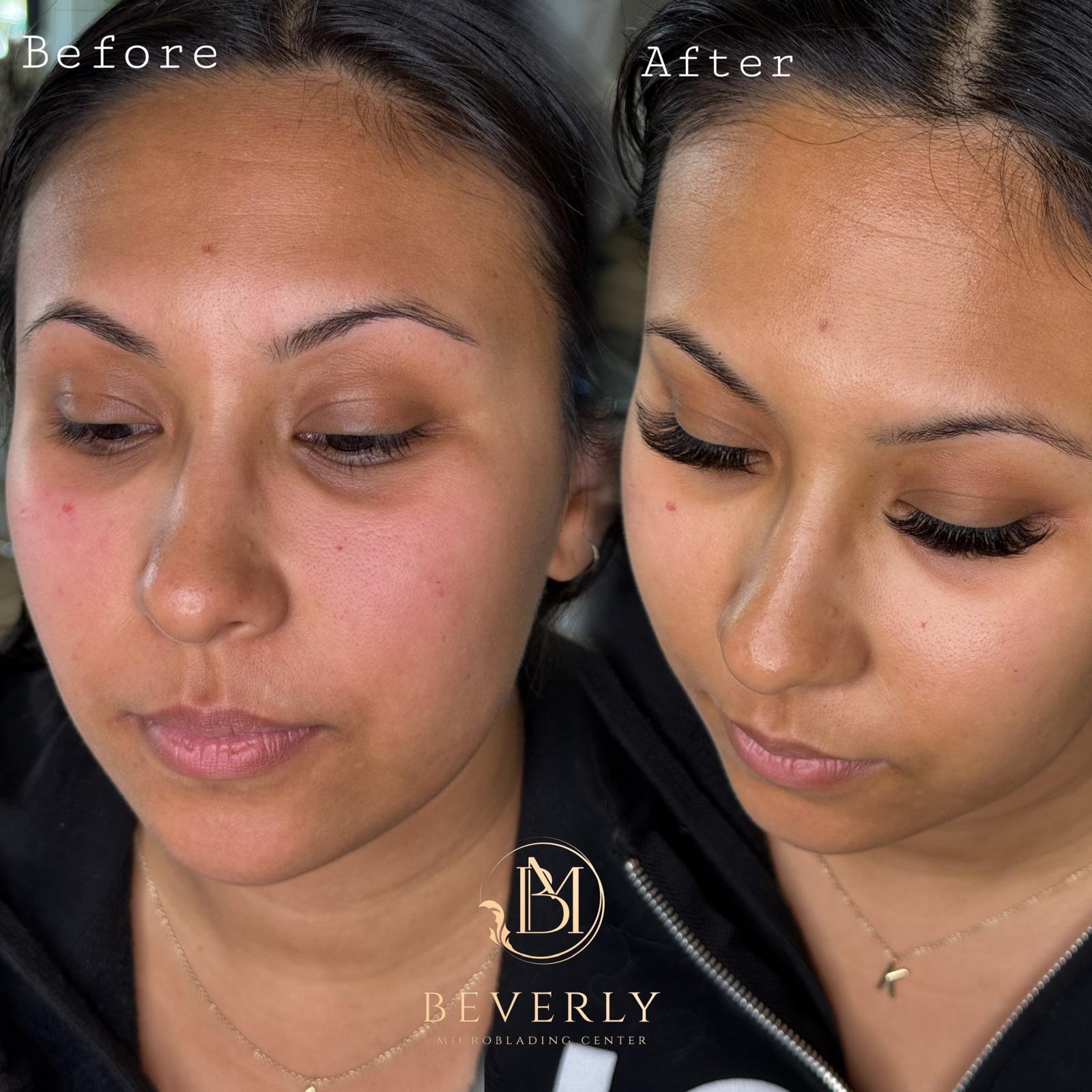 services before after (41)
