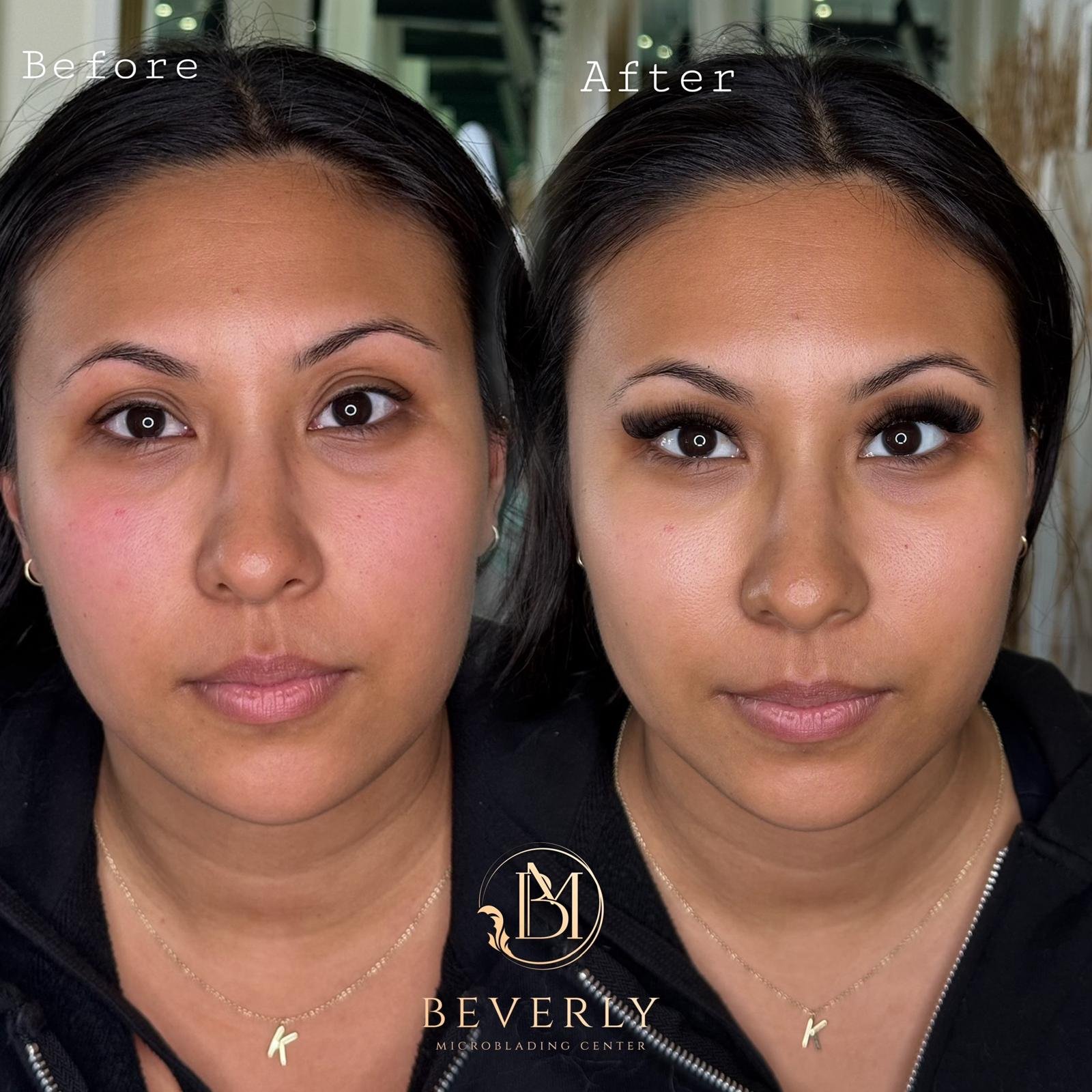 services before after (42)