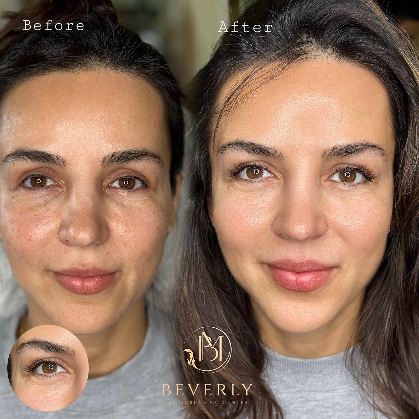 services before after (43)