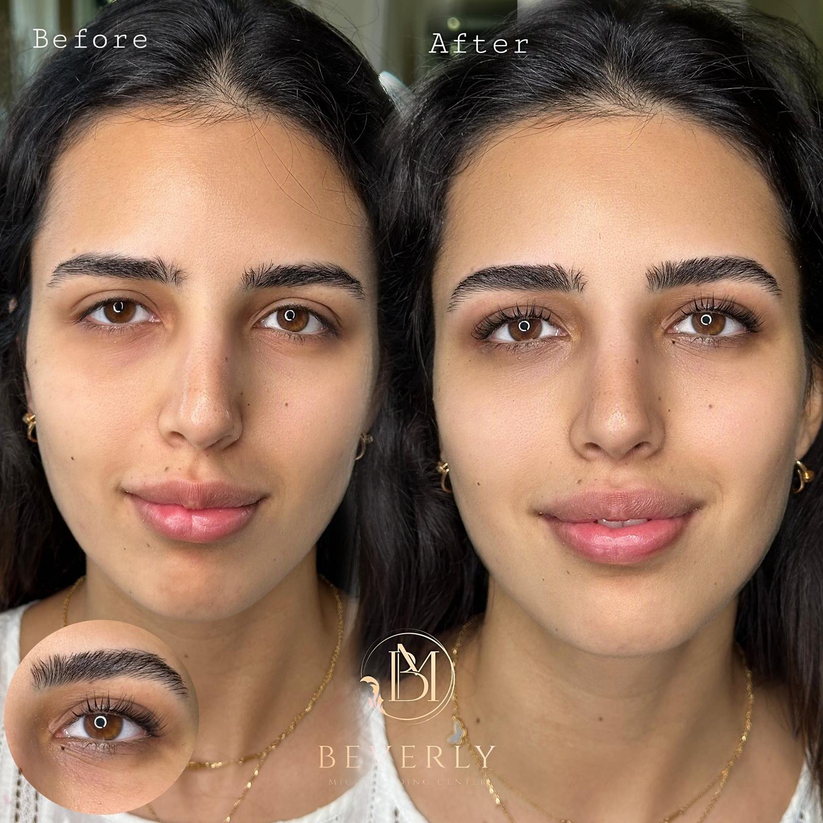 services before after (44)