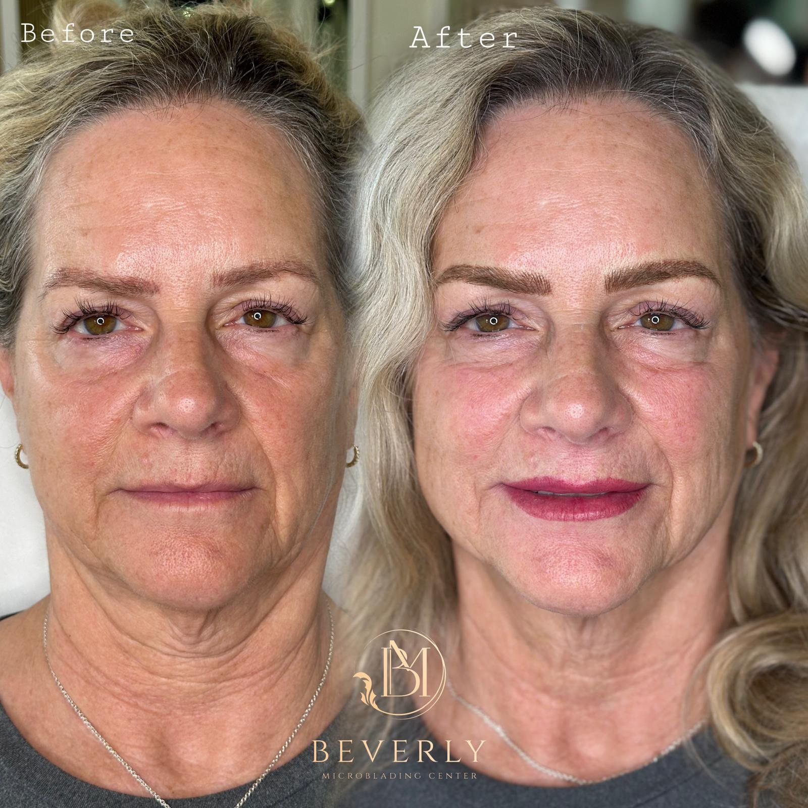 services before after (45)