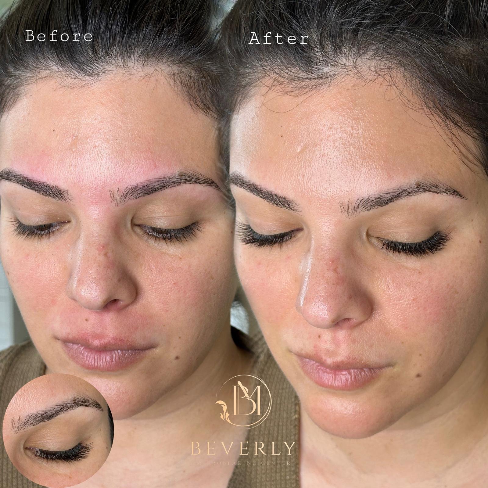 services before after (46)