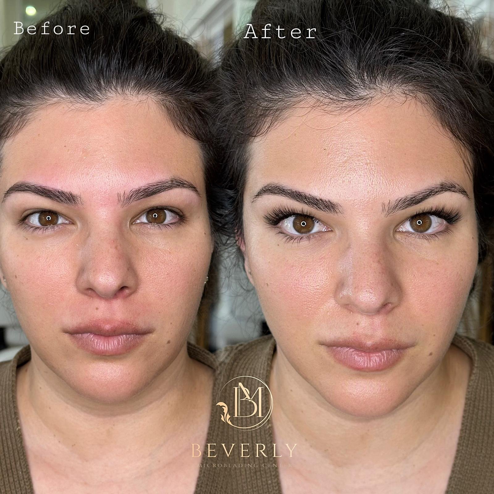 services before after (47)