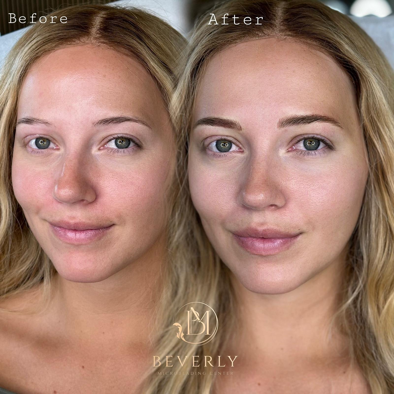 services before after (49)