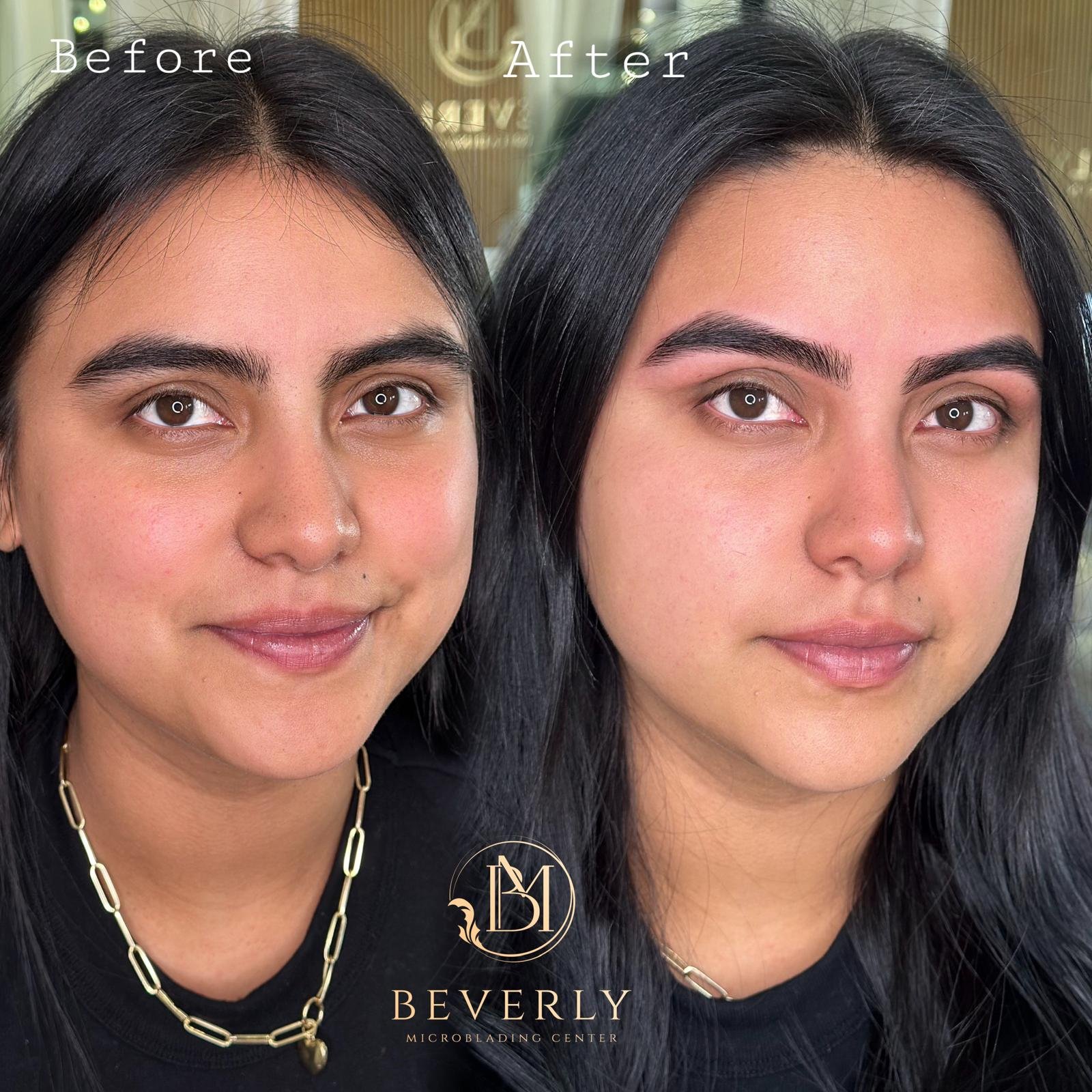 services before after (5)