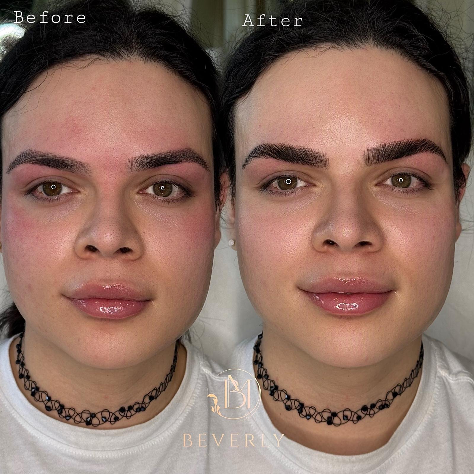services before after (50)