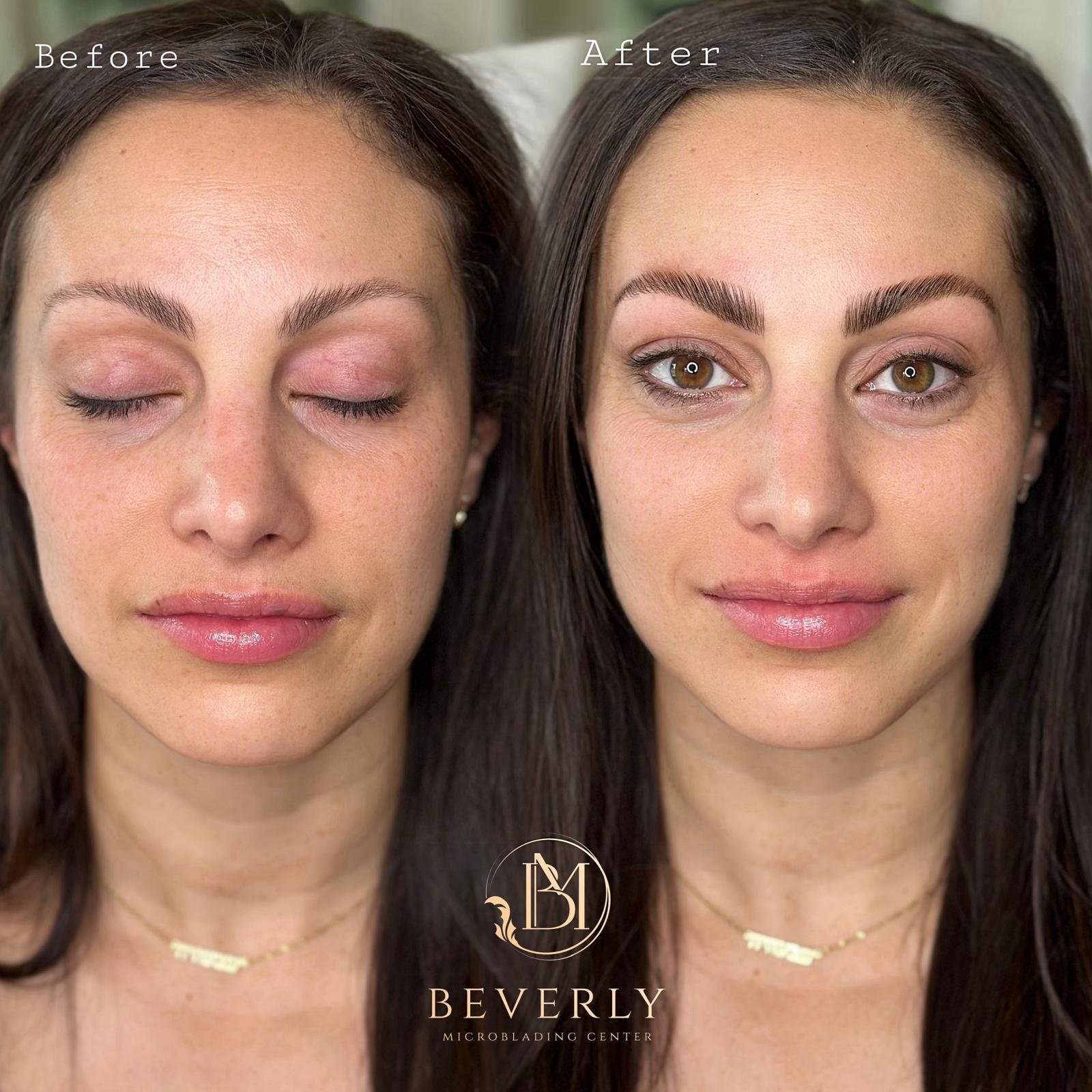 services before after (51)
