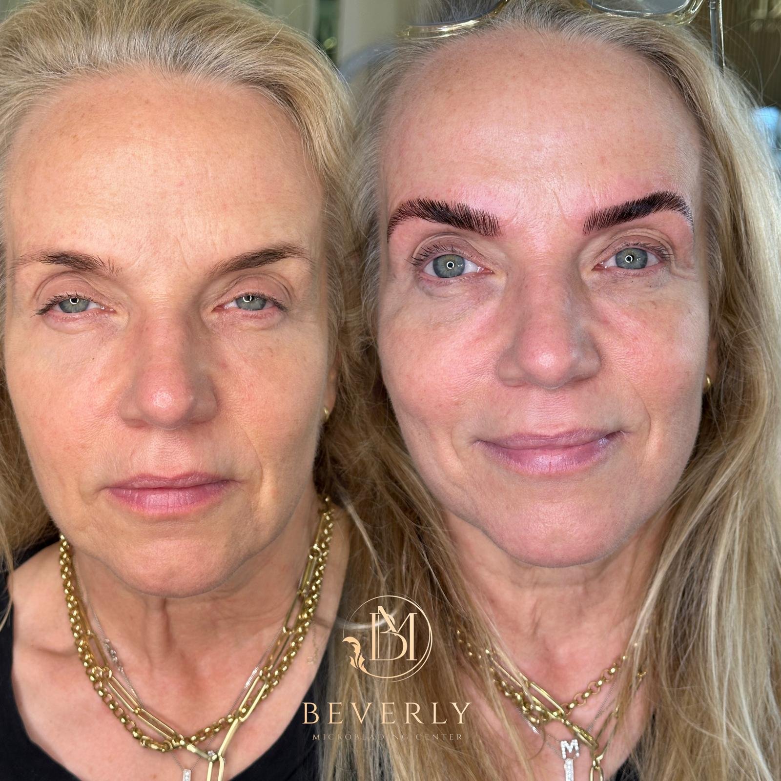 services before after (52)