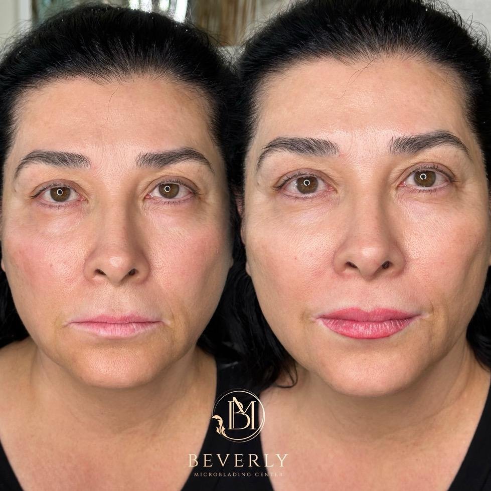 services before after (53)