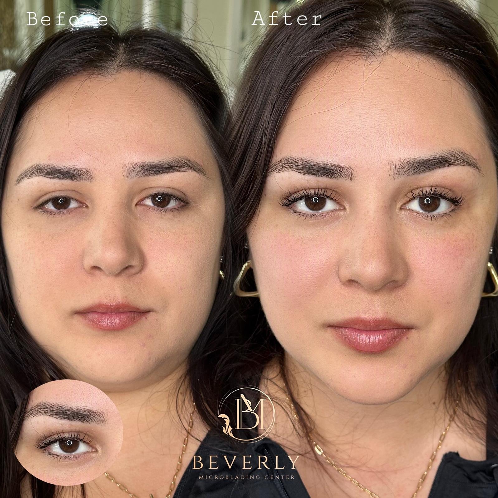 services before after (54)
