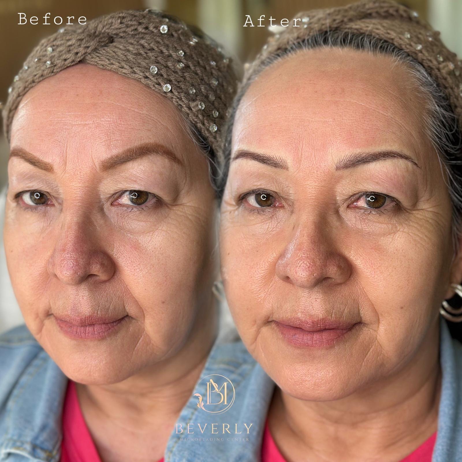 services before after (6)