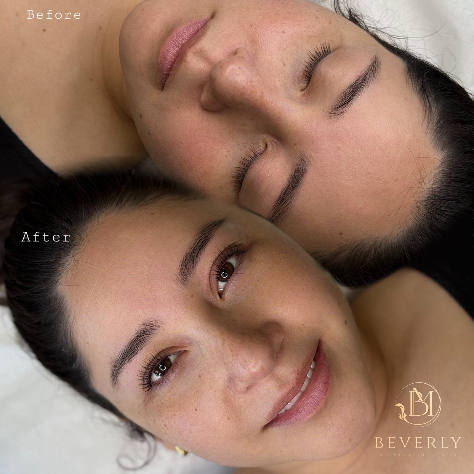 services before after (7)