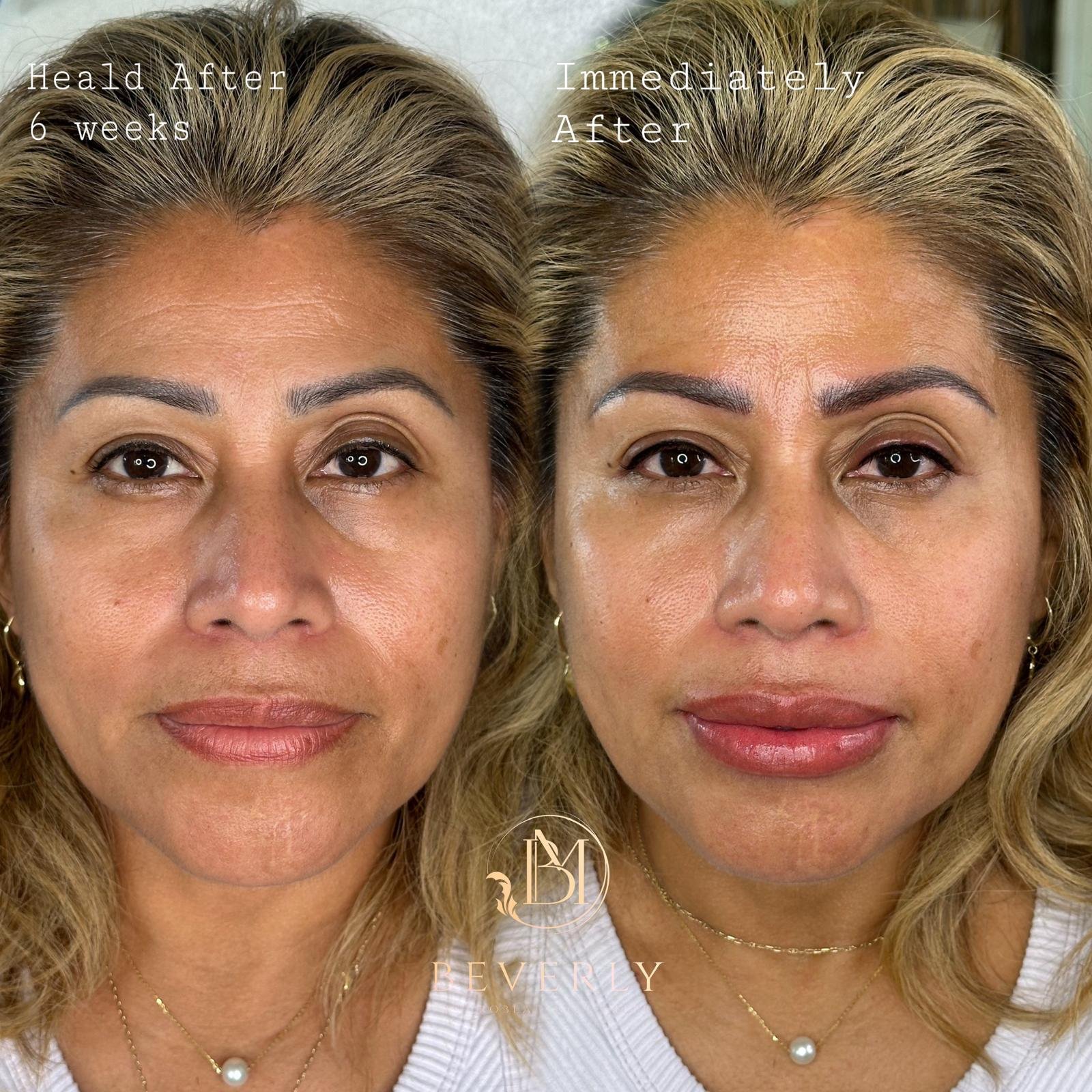 services before after (9)
