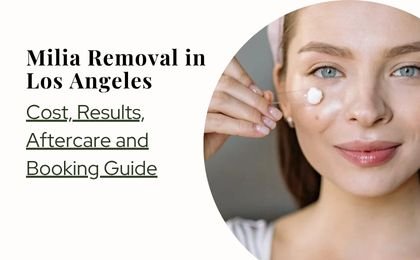 Milia Removal in Los Angeles: Cost, Results & Treatment Guide