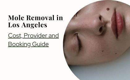 Mole Removal in Los Angeles—Cost, Provider and Booking Guide