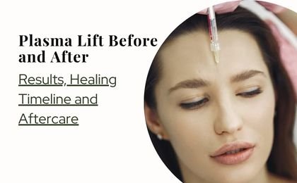 Plasma Lift Before and After — Results, Healing Timeline and Aftercare