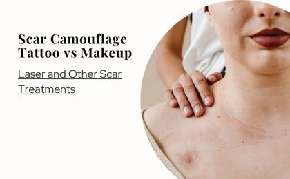 Scar Camouflage Tattoo vs Makeup, Laser and Other Scar Treatments